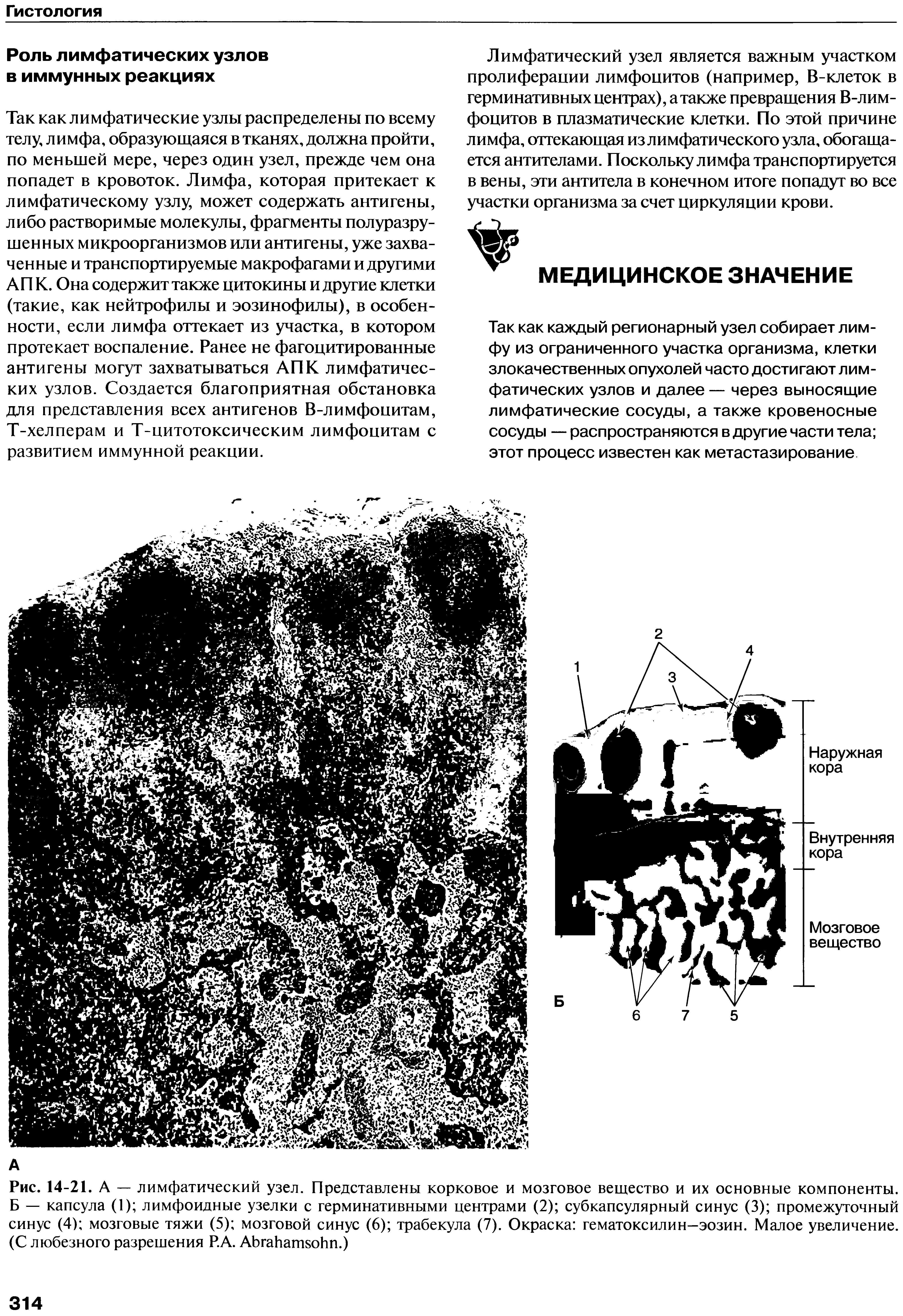 Рис. 14-21. А — лимфатический узел. Представлены корковое и мозговое вещество и их основные компоненты. Б — капсула (1) лимфоидные узелки с герминативными центрами (2) субкапсулярный синус (3) промежуточный синус (4) мозговые тяжи (5) мозговой синус (6) трабекула (7). Окраска гематоксилин—эозин. Малое увеличение. (С любезного разрешения Р.А. АЬгаЬатзоЬп.)...