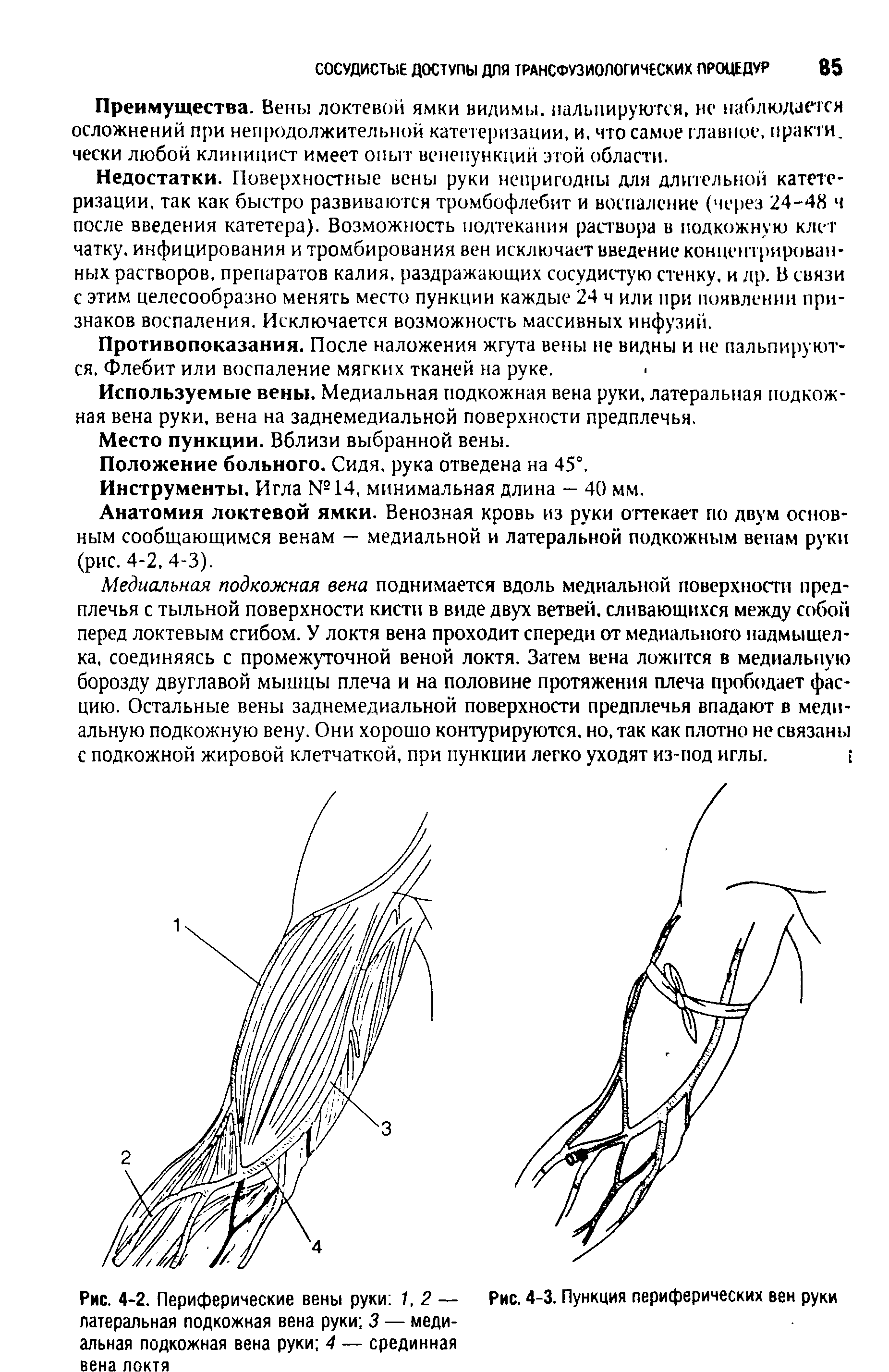 Рис. 4-2. Периферические вены руки 1, 2 — Рис. 4-3. Пункция периферических вен руки латеральная подкожная вена руки 3 — медиальная подкожная вена руки 4 — срединная...