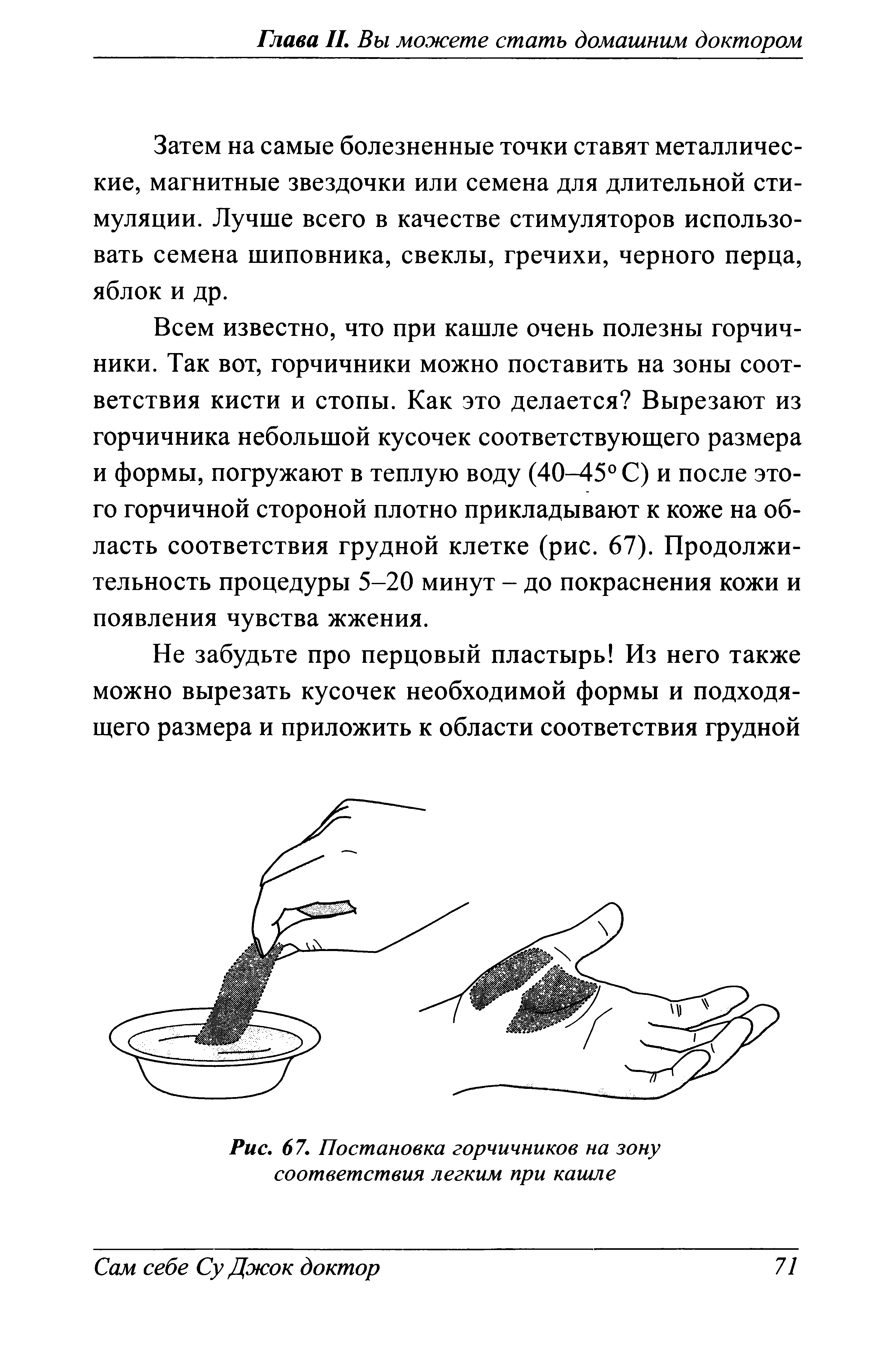 Рис. 67. Постановка горчичников на зону соответствия легким при кашле...