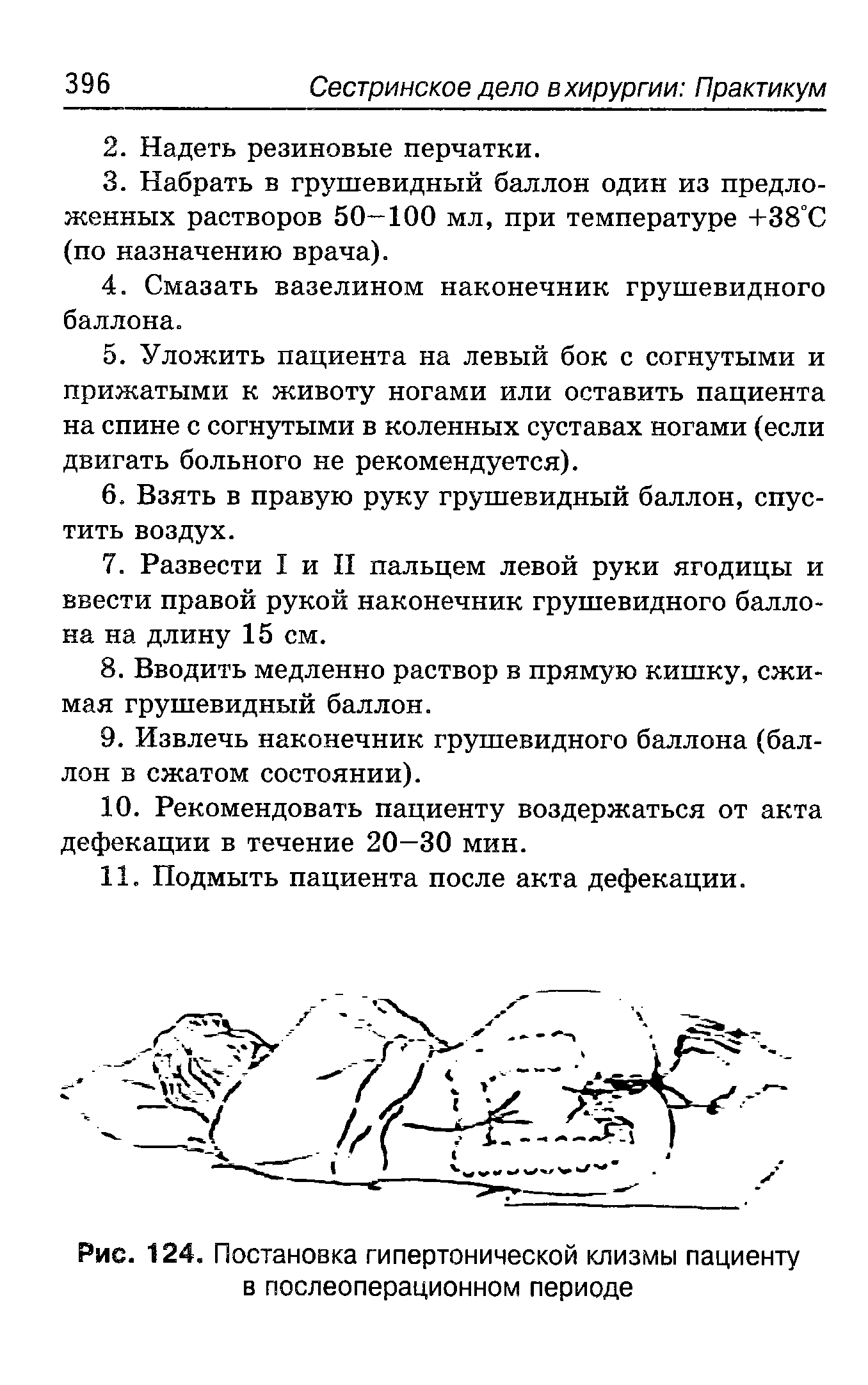 Рис. 124. Постановка гипертонической клизмы пациенту в послеоперационном периоде...