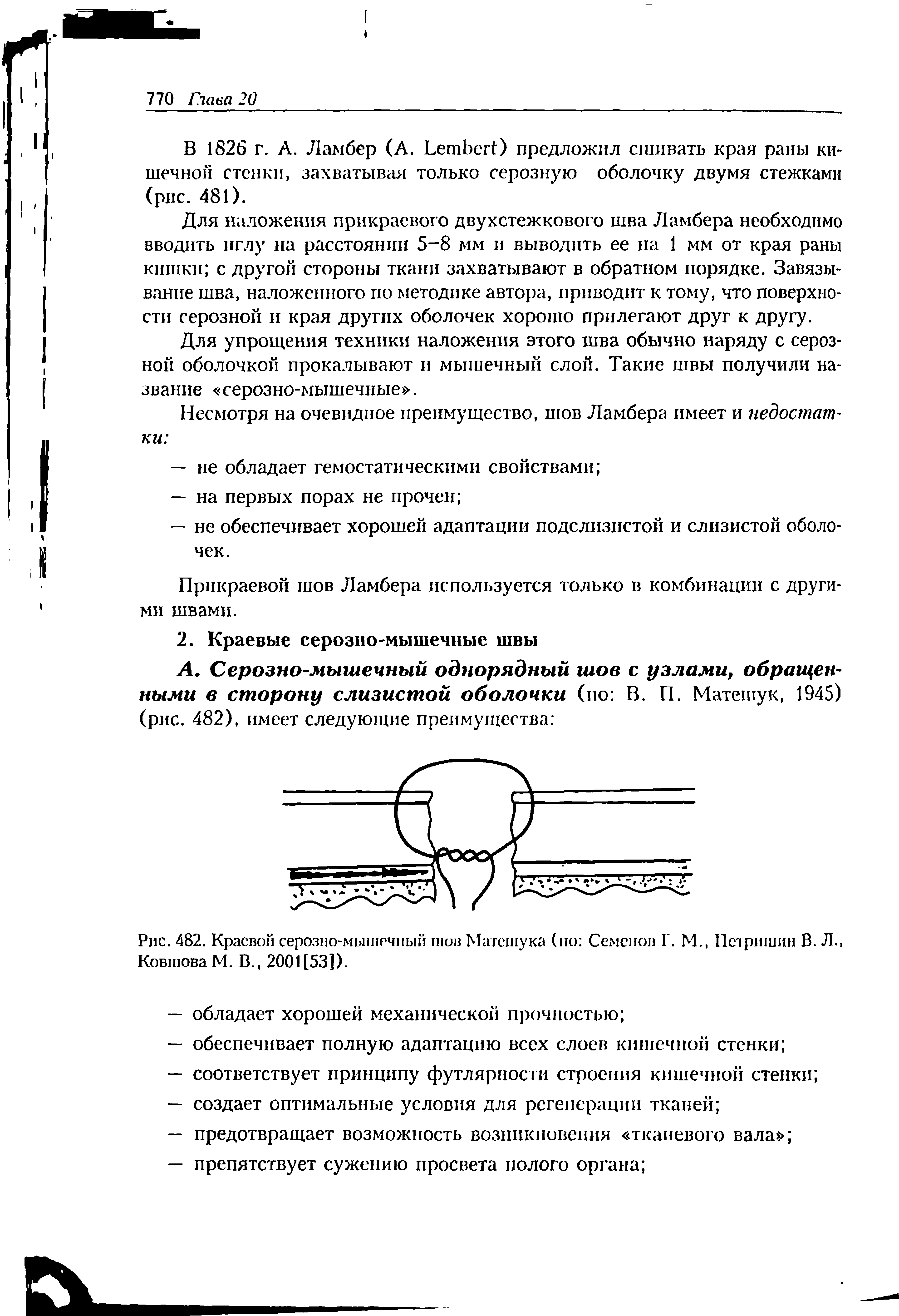 Рис. 482. Краевой серозно-мышечный шов Матсшука (но Семенов Г. М., Пстришин В. Л., Ковшова М. В., 2001(53]).