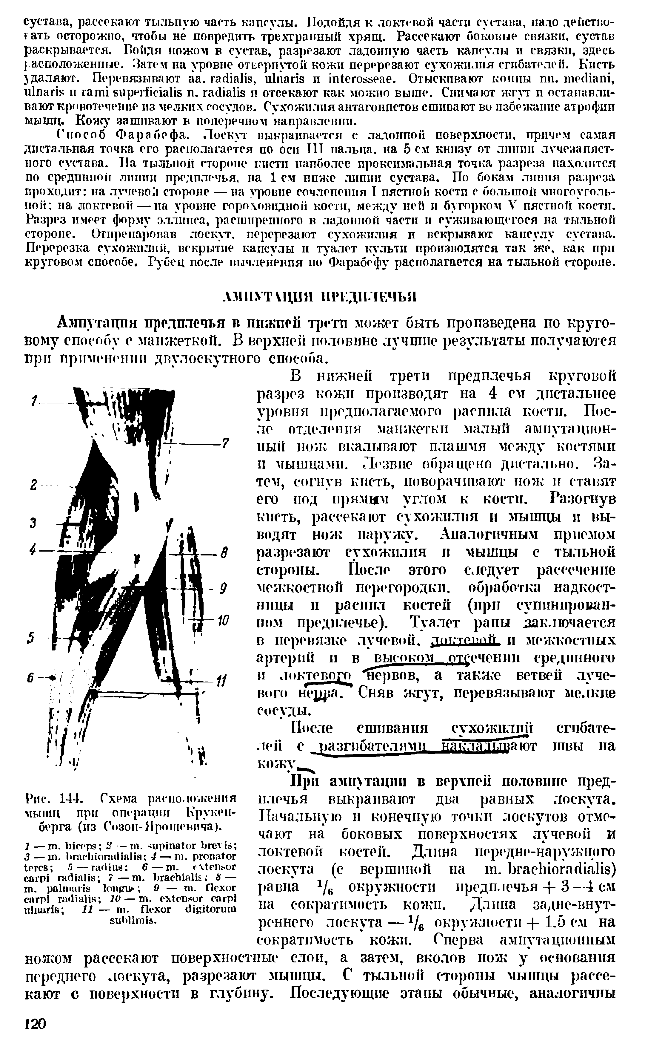 Рис. 144. Схема расположения мышц при операции Крукенберга (из Созоп-Ярошевича).