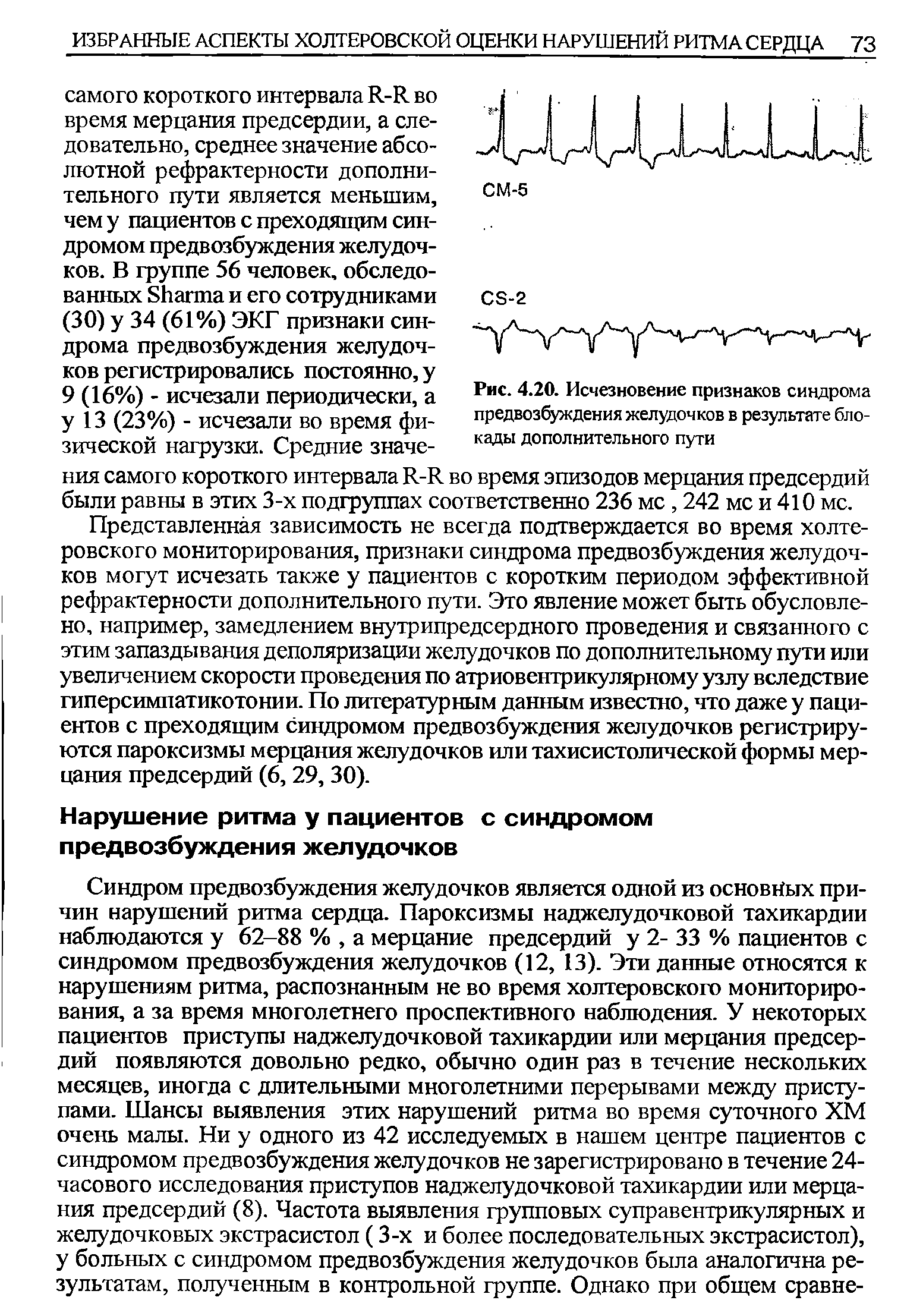 Рис. 4.20. Исчезновение признаков синдрома предвозбуждения желудочков в результате блокады дополнительного пути...