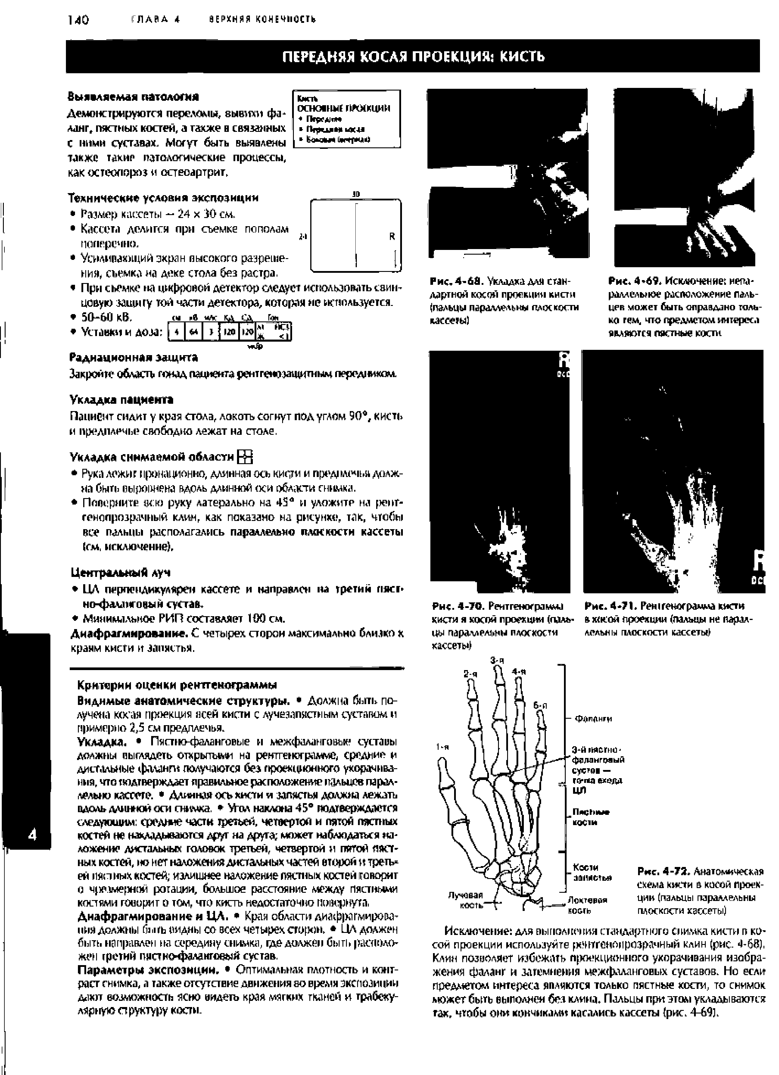 Рис. 4-ДЙ. Уклддхадля стандартной косом проекции кисти (пальцы параллельны плоскости кассеты)...