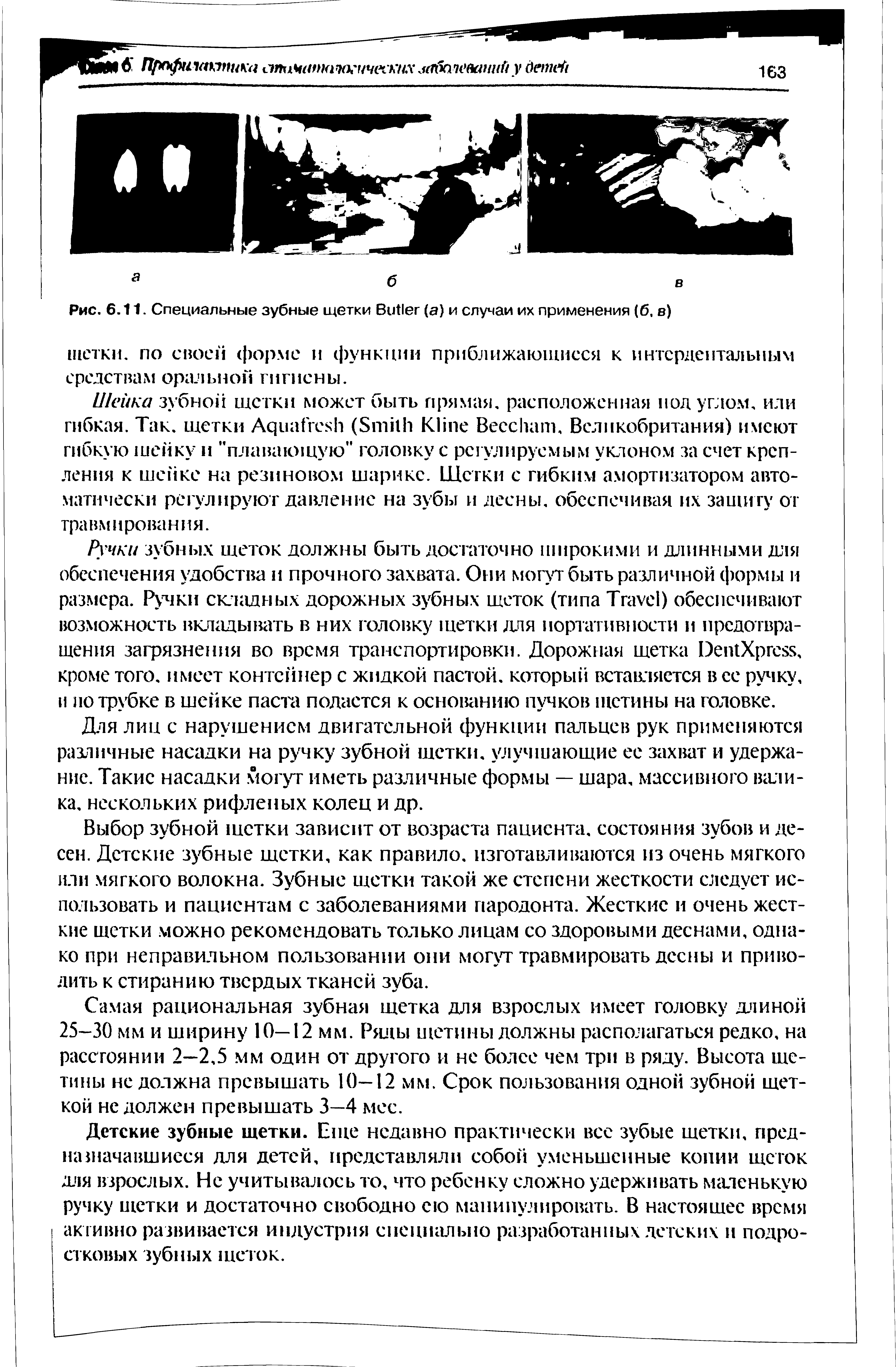 Рис. 6.11. Специальные зубные щетки B (а) и случаи их применения (б, в)...