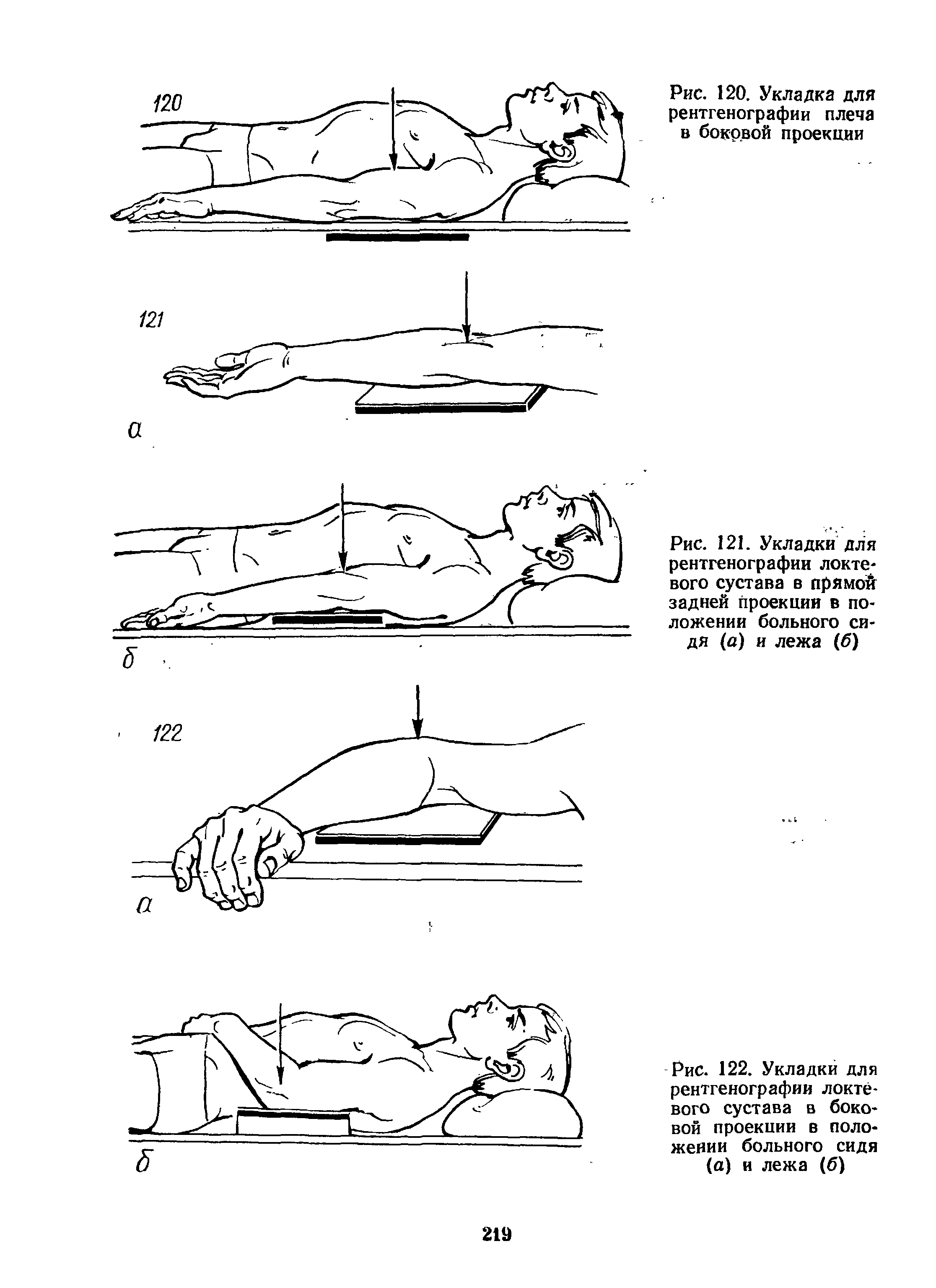 Рис. 122. Укладки для рентгенографии локтевого сустава в боковой проекции в положении больного сидя (а) и лежа (б)...