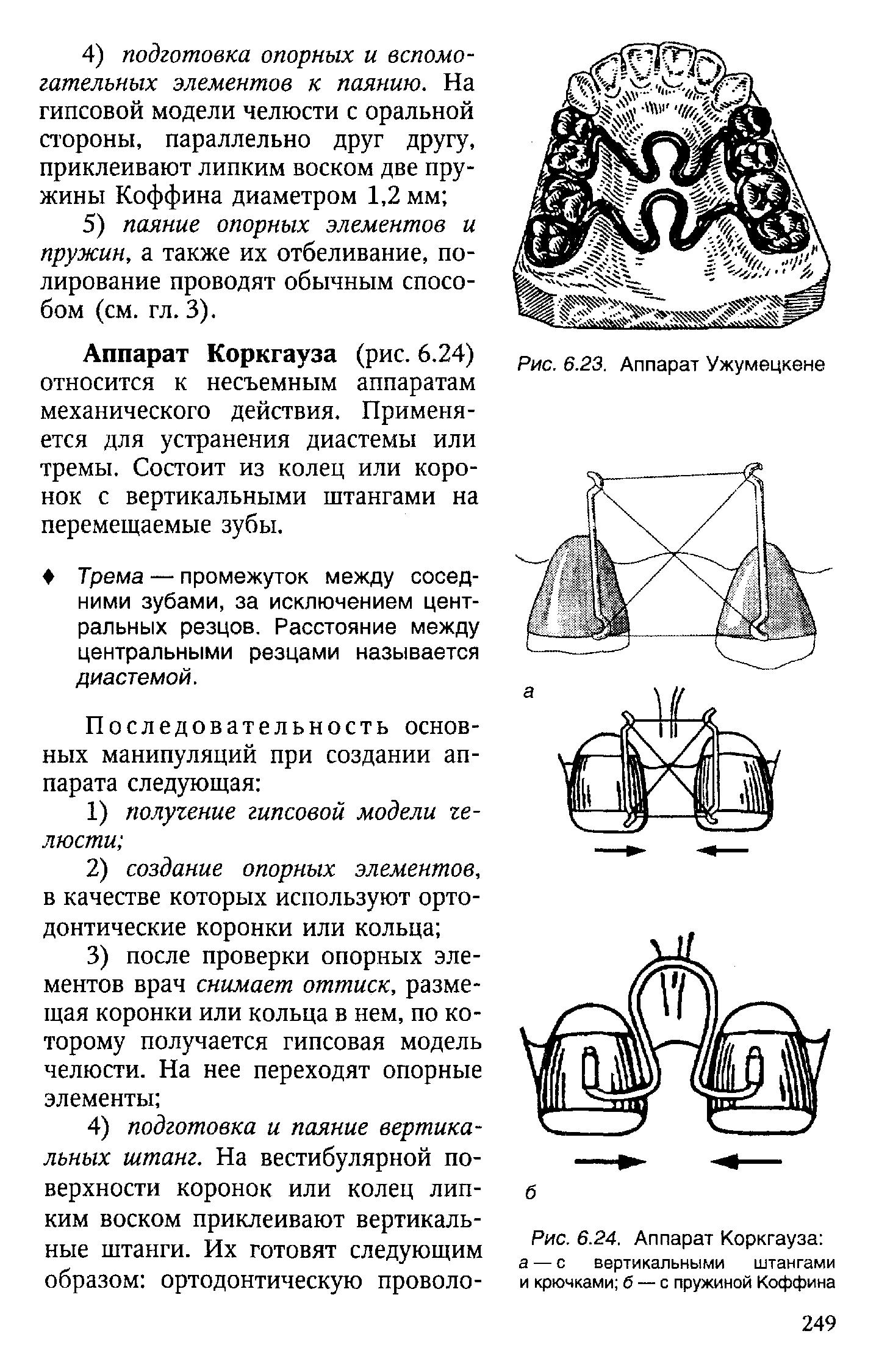 Рис. 6.24. Аппарат Коркгауза а — с вертикальными штангами и крючками б — с пружиной Коффина...