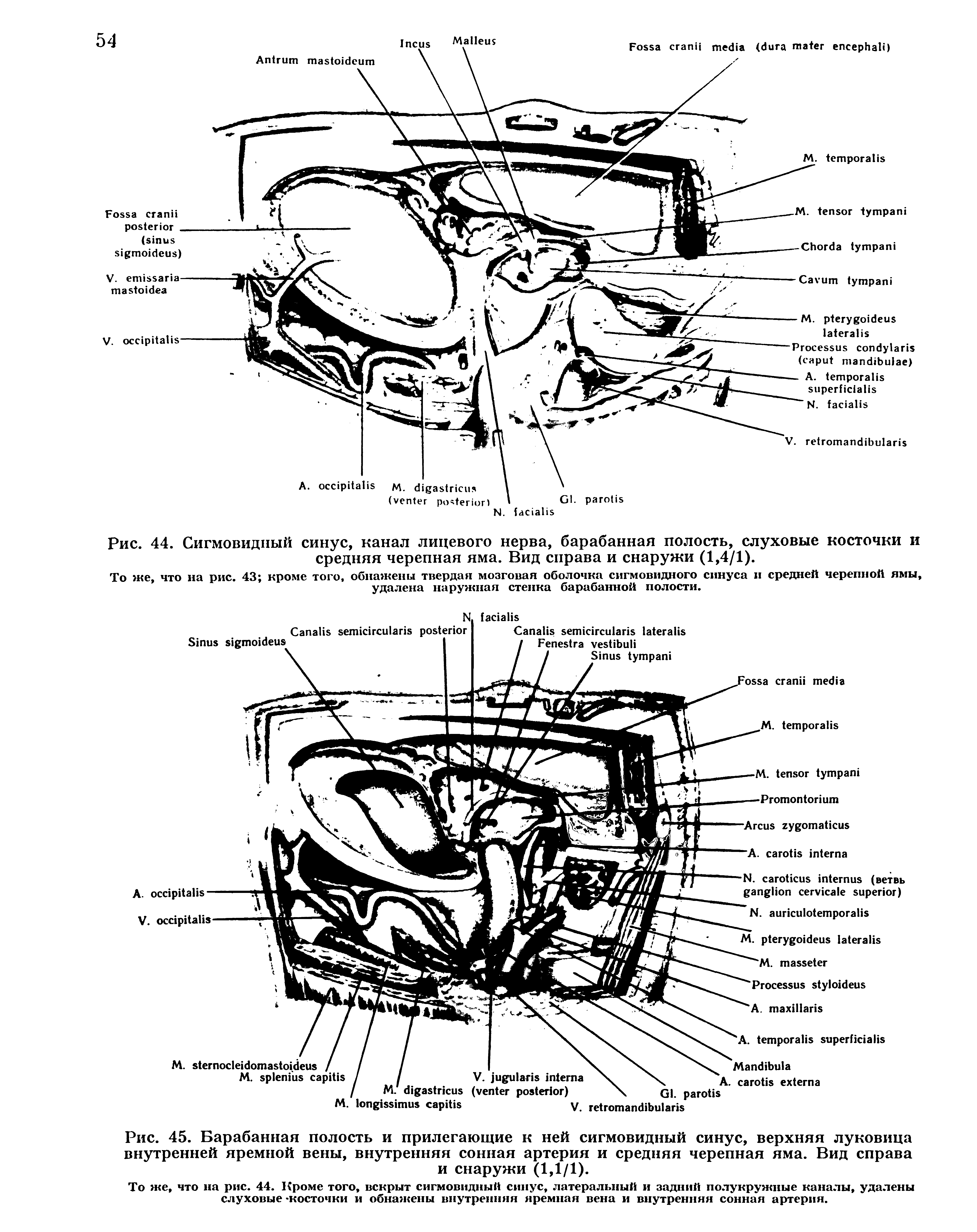 Рис. 45. Барабанная полость и прилегающие к ней сигмовидный синус, верхняя луковица внутренней яремной вены, внутренняя сонная артерия и средняя черепная яма. Вид справа и снаружи (1,1/1).