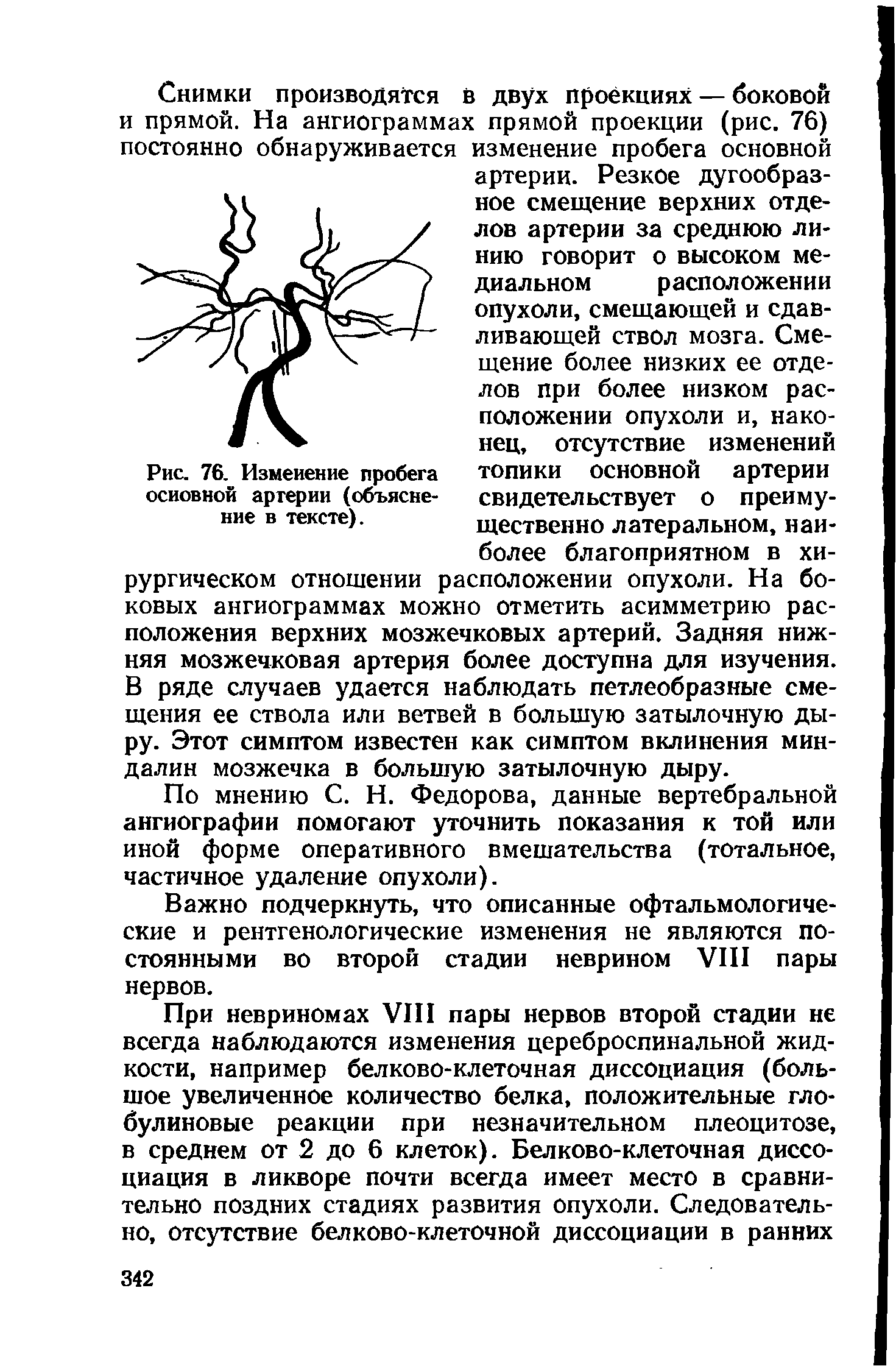 Рис. 76. Изменение пробега топики основной артерии основной артерии (объясне- свидетельствует о преиму-...