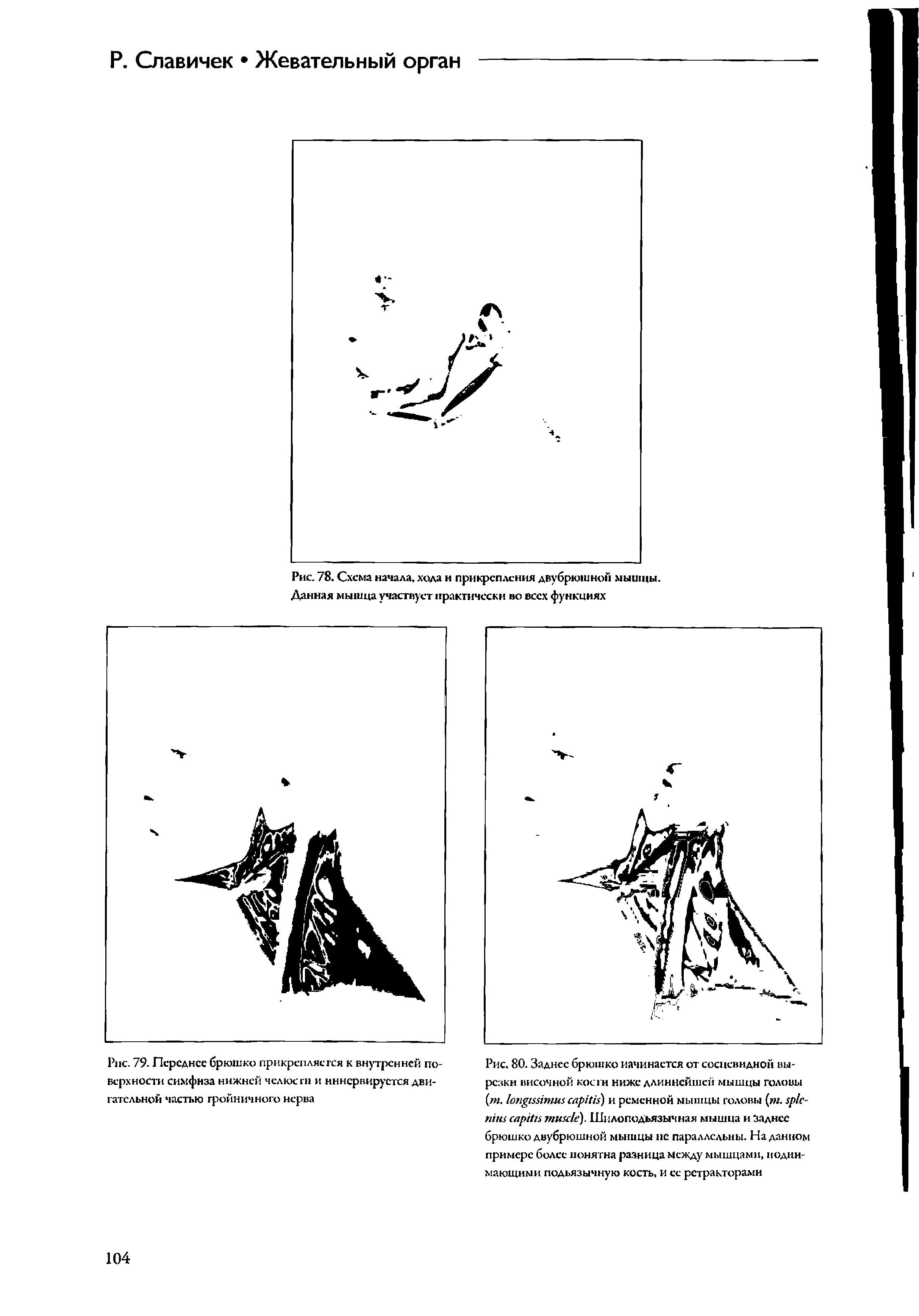 Рис. 78. Схема начала, хода и прикрепления двубрюшной мышцы. Данная мышца участвует практически во всех функциях...