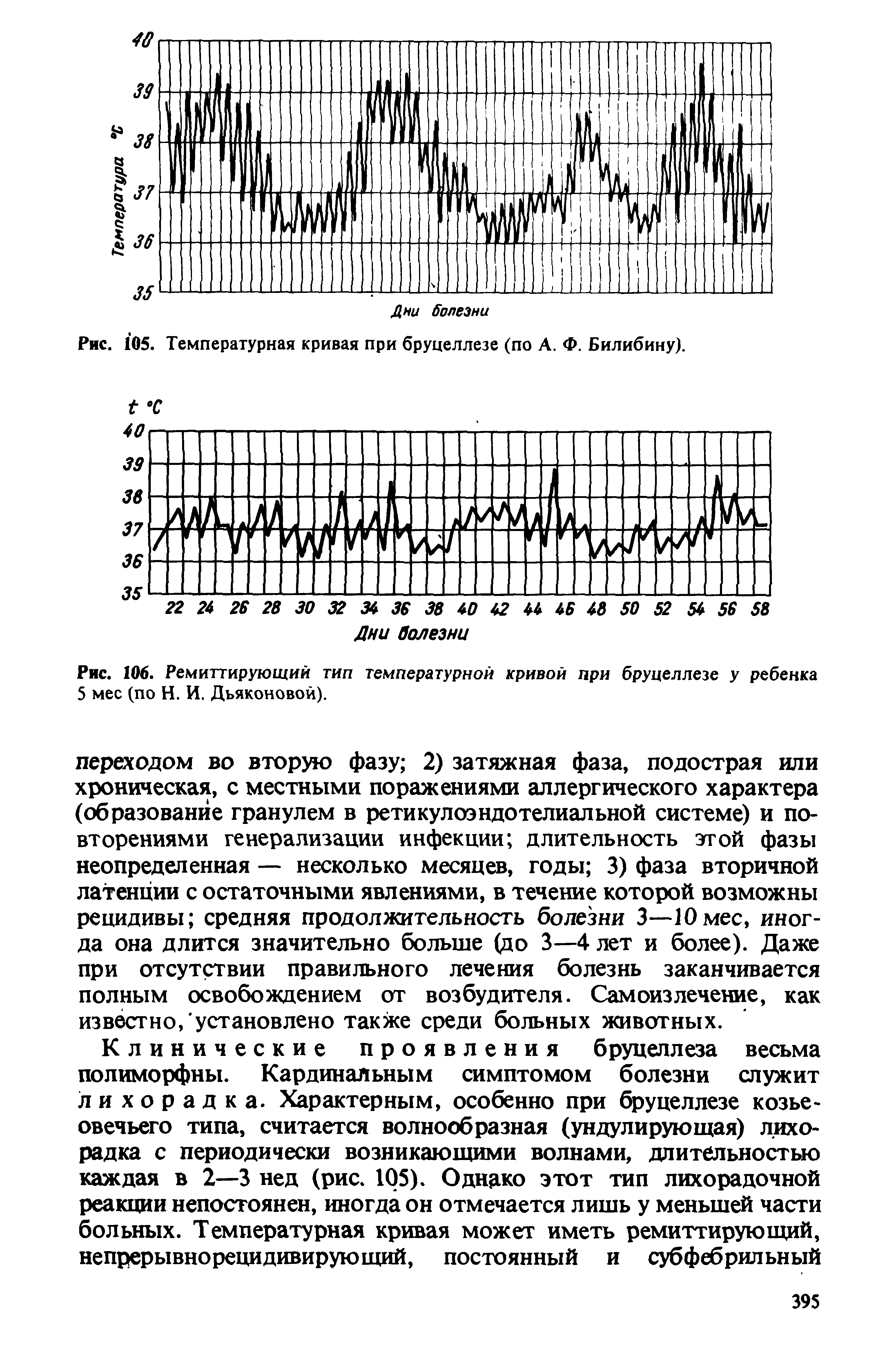 Рис. 106. Ремиттирующий тип температурной кривой при бруцеллезе у ребенка 5 мес (по Н. И. Дьяконовой).