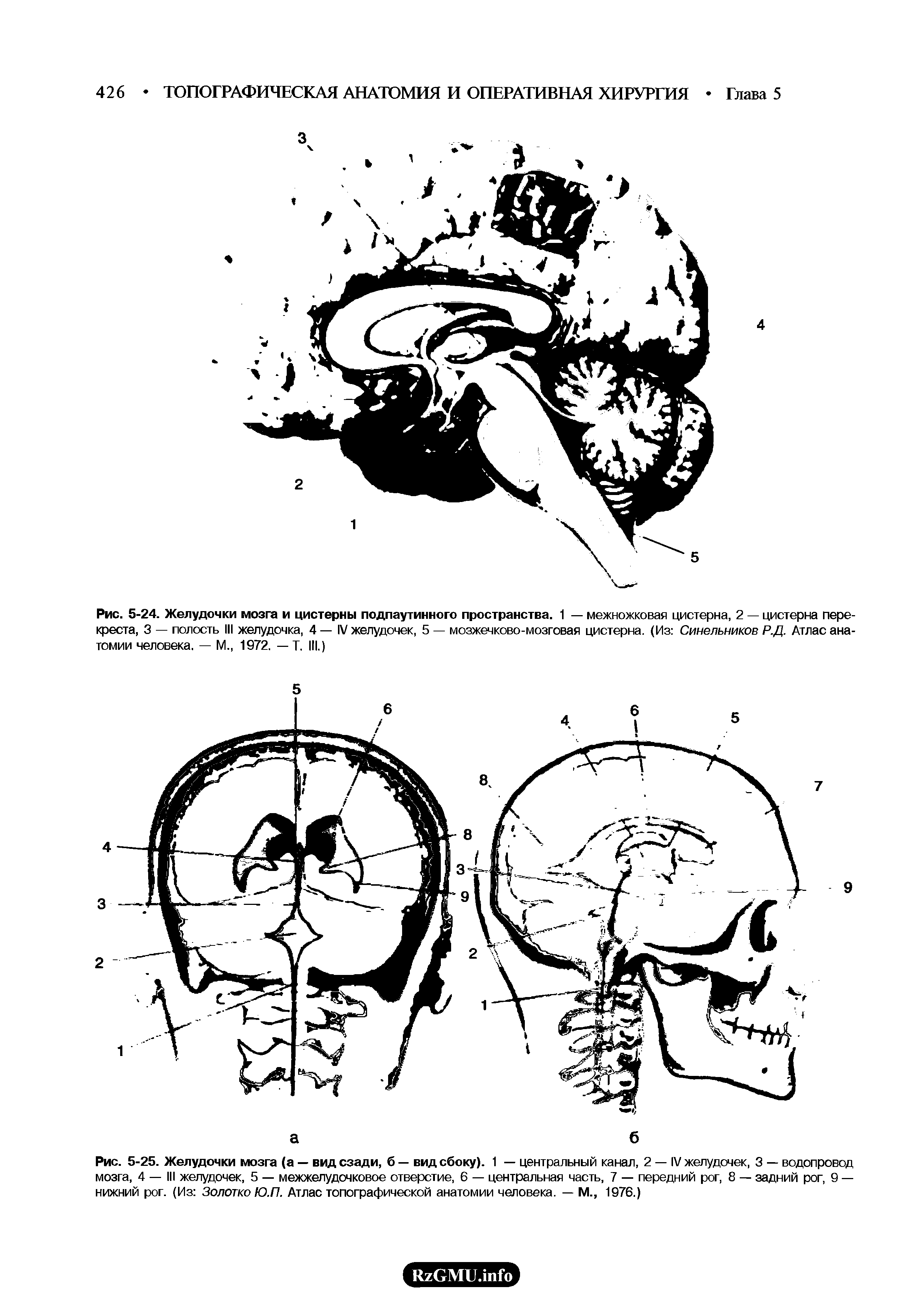 Рис. 5-24. Желудочки мозга и цистерны подпаутинного пространства. 1 — межножковая цистерна, 2 — цистерна перекреста, 3 — полость III желудочка, 4 — IV желудочек, 5 — мозжечково-мозговая цистерна. (Из Синельников Р.Д. Атлас анатомии человека. — М., 1972. — Т. III.)...