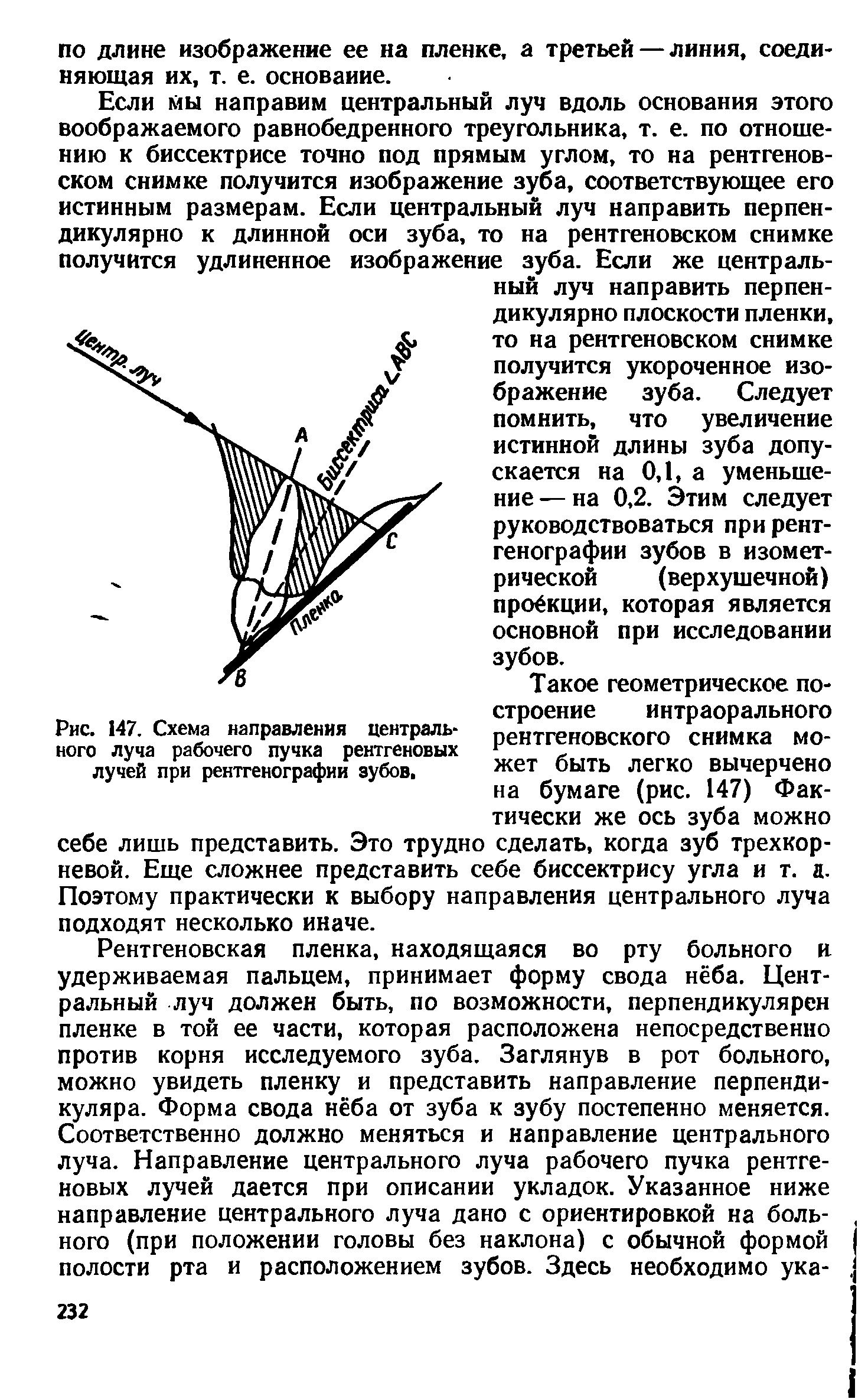 Рис. 147. Схема направления центрального луча рабочего пучка рентгеновых лучей при рентгенографии зубов.