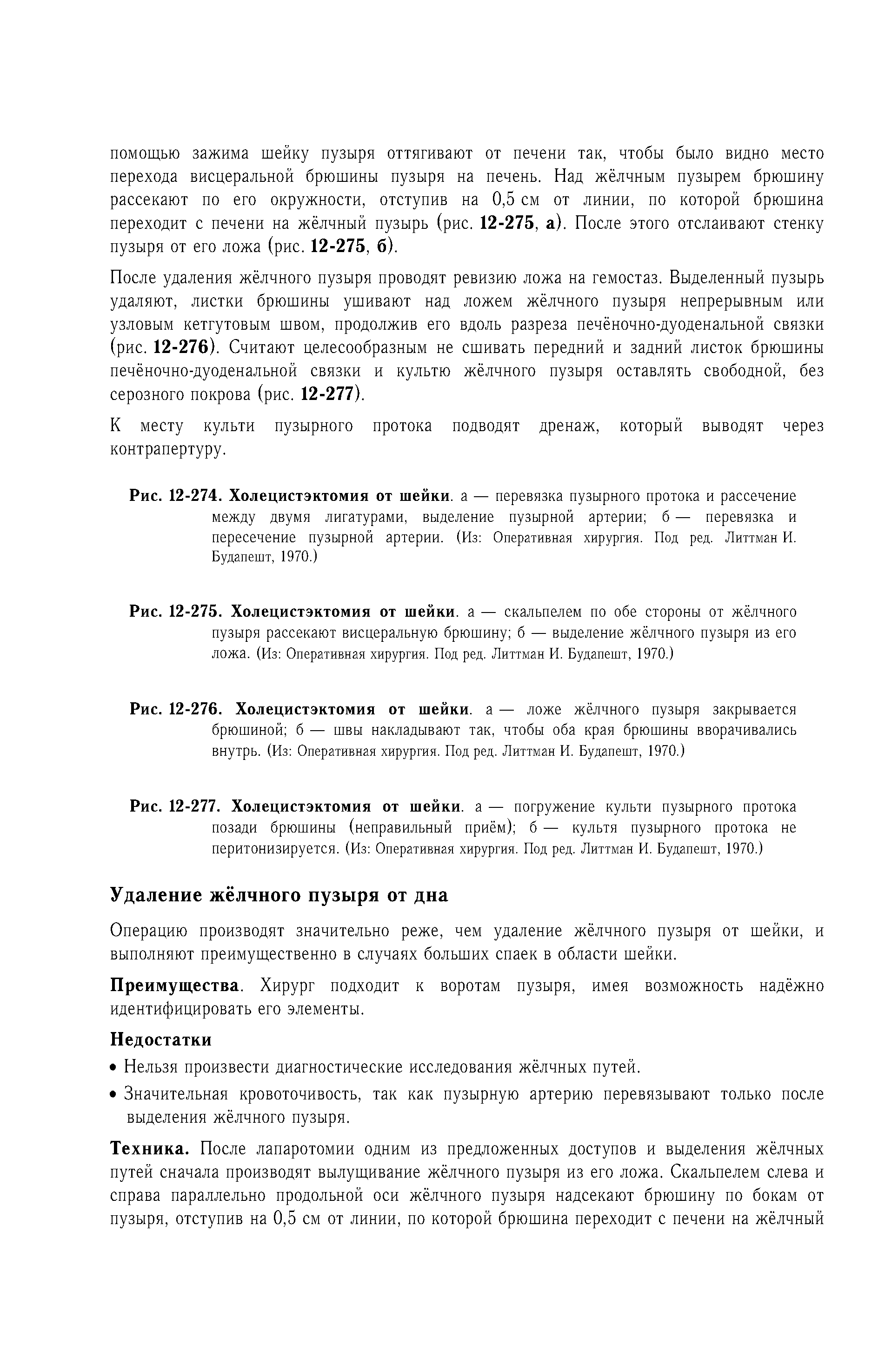 Рис. 12-274. Холецистэктомия от шейки, а — перевязка пузырного протока и рассечение между двумя лигатурами, выделение пузырной артерии б — перевязка и пересечение пузырной артерии. (Из Оперативная хирургия. Под ред. Литтман И. Будапешт, 1970.)...