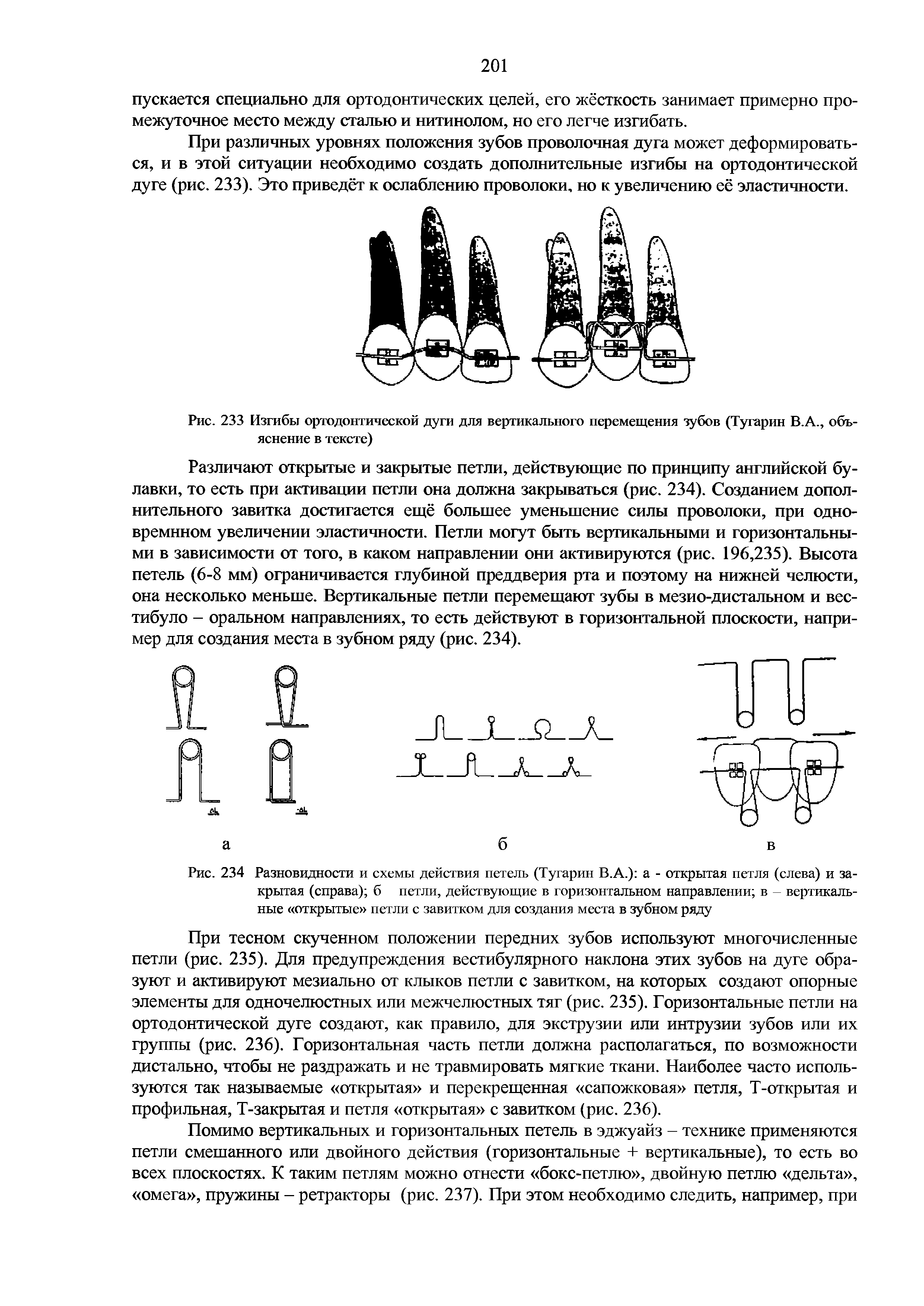 Рис. 234 Разновидности и схемы действия петель (Тугарин В.А.) а - открытая петля (слева) и закрытая (справа) б петли, действующие в горизонтальном направлении в - вертикальные открытые петли с завитком для создания места в зубном ряду...