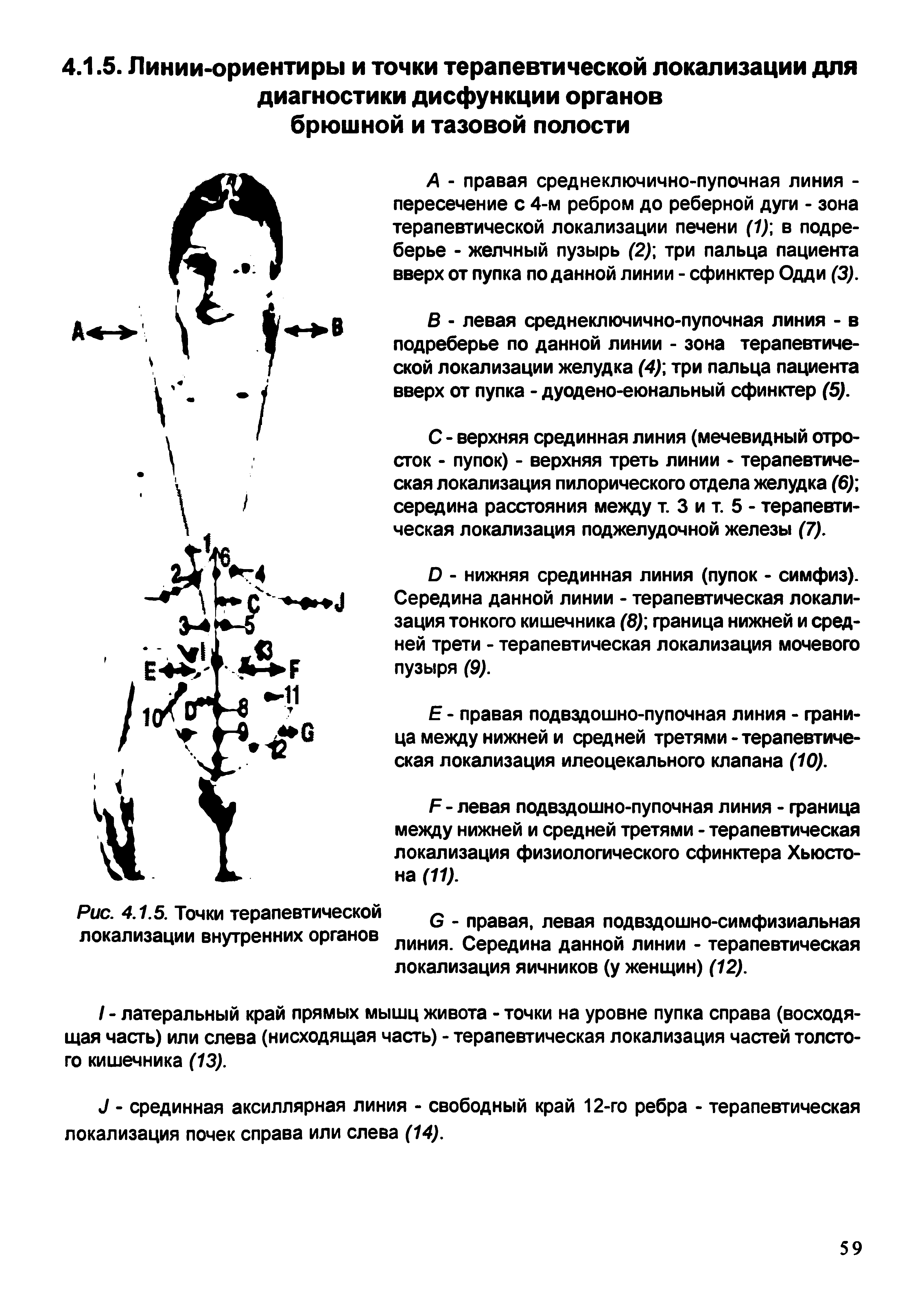 Рис. 4.1.5. Точки терапевтической правая левая подвздошно-симфизиальная локализации внутренних органов линия Середина данной линии - терапевтическая локализация яичников (у женщин) (12).