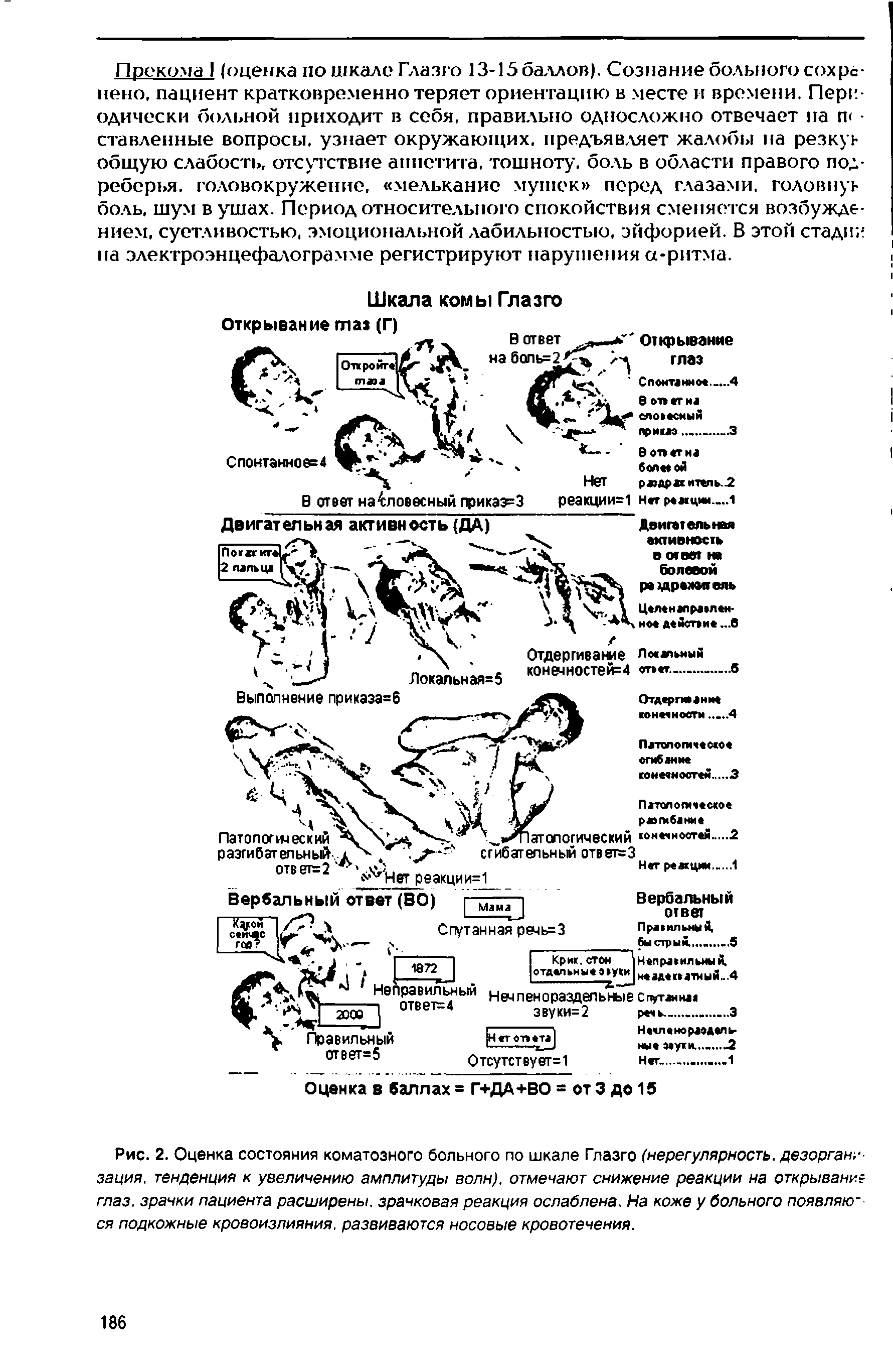 Рис. 2. Оценка состояния коматозного больного по шкале Глазго (нерегулярность, дезорган.-зация. тенденция к увеличению амплитуды волн), отмечают снижение реакции на открывание глаз, зрачки пациента расширены, зрачковая реакция ослаблена. На коже у больного появлякг ся подкожные кровоизлияния, развиваются носовые кровотечения.