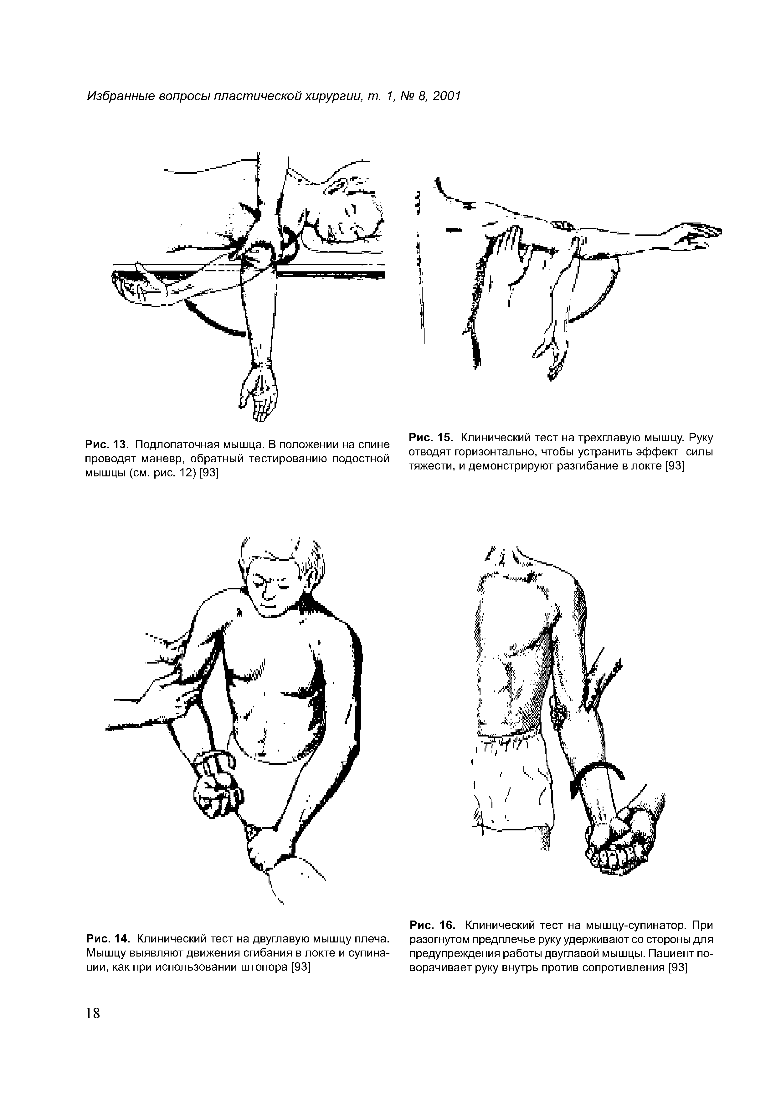 Рис. 15. Клинический тест на трехглавую мышцу. Руку отводят горизонтально, чтобы устранить эффект силы тяжести, и демонстрируют разгибание в локте [93]...