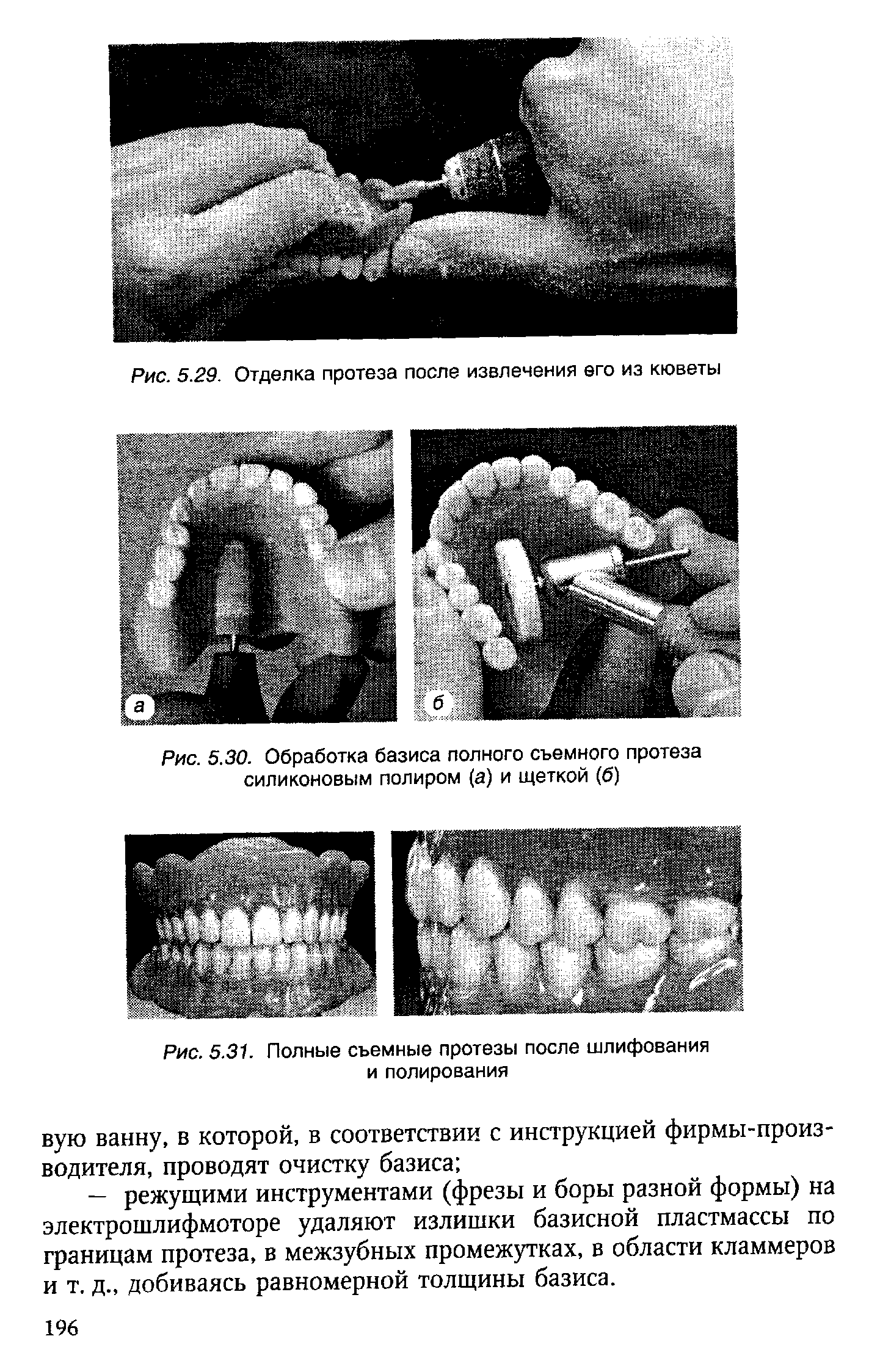 Рис. 5.30. Обработка базиса полного съемного протеза силиконовым полиром (а) и щеткой (б)...