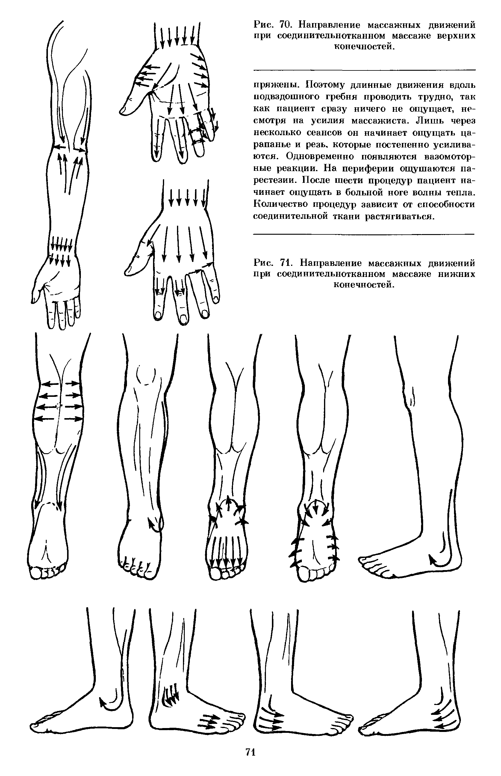 Рис. 71. Направление массажных движений при соединительнотканном массаже нижних конечностей.