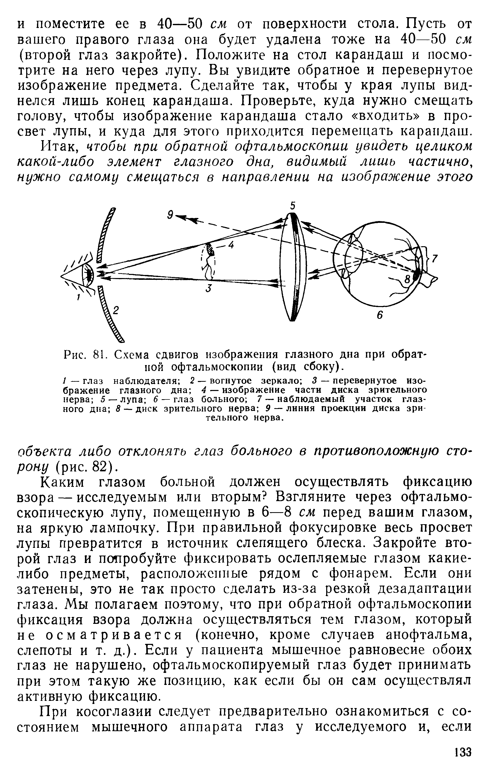 Рис. 81. Схема сдвигов изображения глазного дна при обратной офтальмоскопии (вид сбоку).