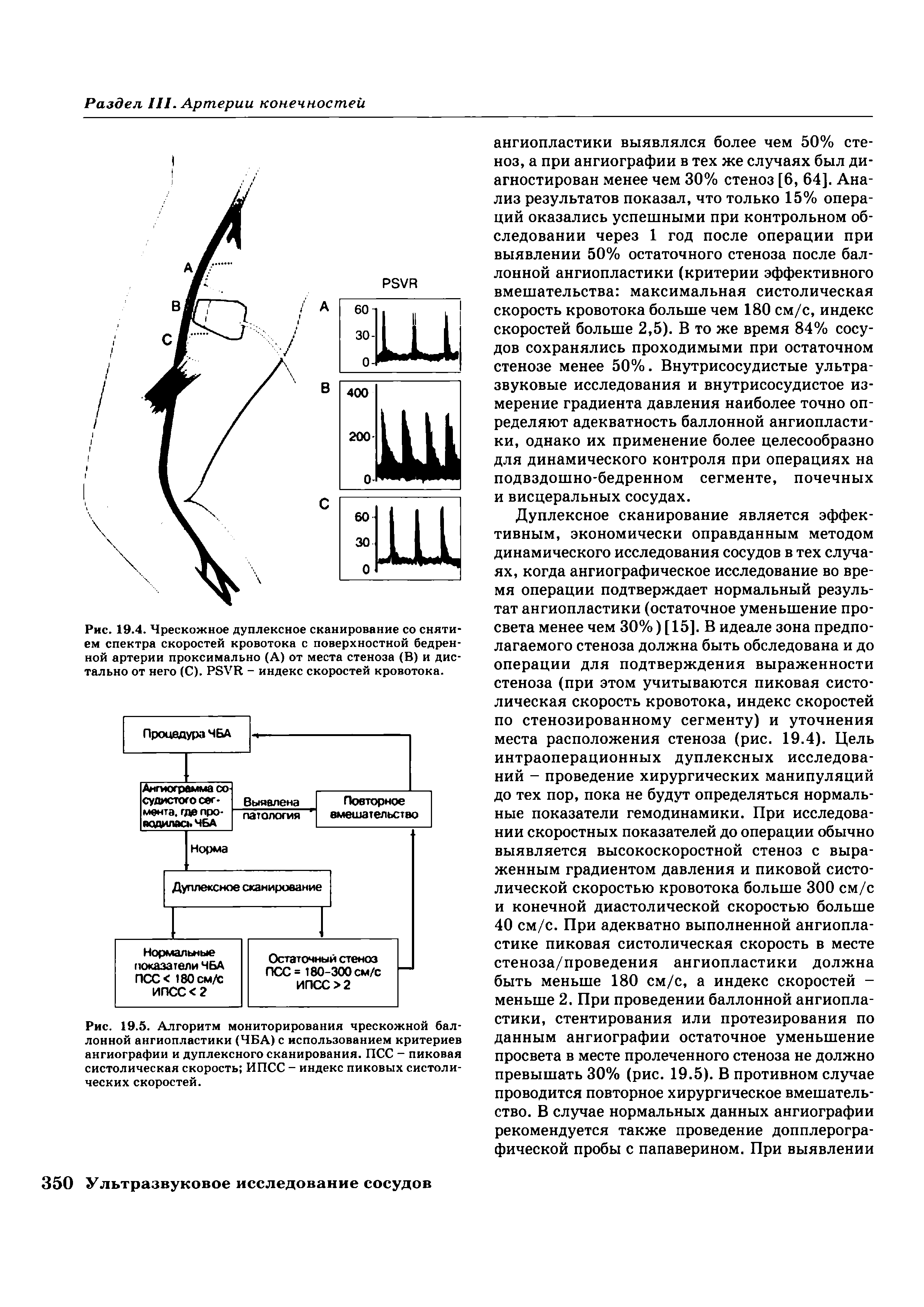 Рис. 19.5. Алгоритм мониторирования чрескожной баллонной ангиопластики (ЧБА) с использованием критериев ангиографии и дуплексного сканирования. ПСС - пиковая систолическая скорость ИПСС - индекс пиковых систолических скоростей.