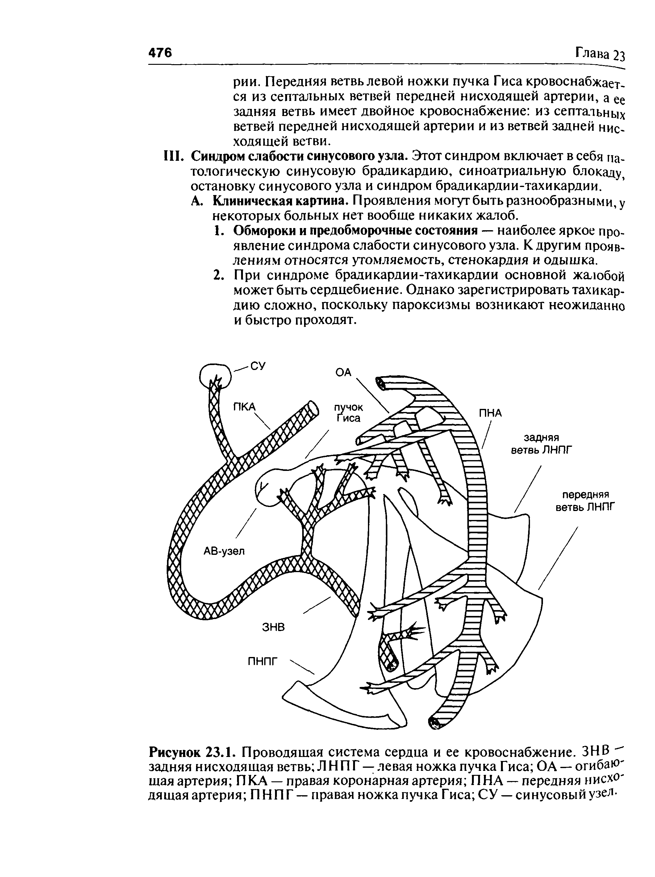Рисунок 23.1. Проводящая система сердца и ее кровоснабжение. ЗНВ " задняя нисходящая ветвь ЛНПГ — левая ножка пучка Гиса ОА — огибаЮ щая артерия ПКА — правая коронарная артерия ПНА — передняя нисхО дящая артерия ПНПГ — правая ножка пучка Гиса СУ — синусовый узел-...