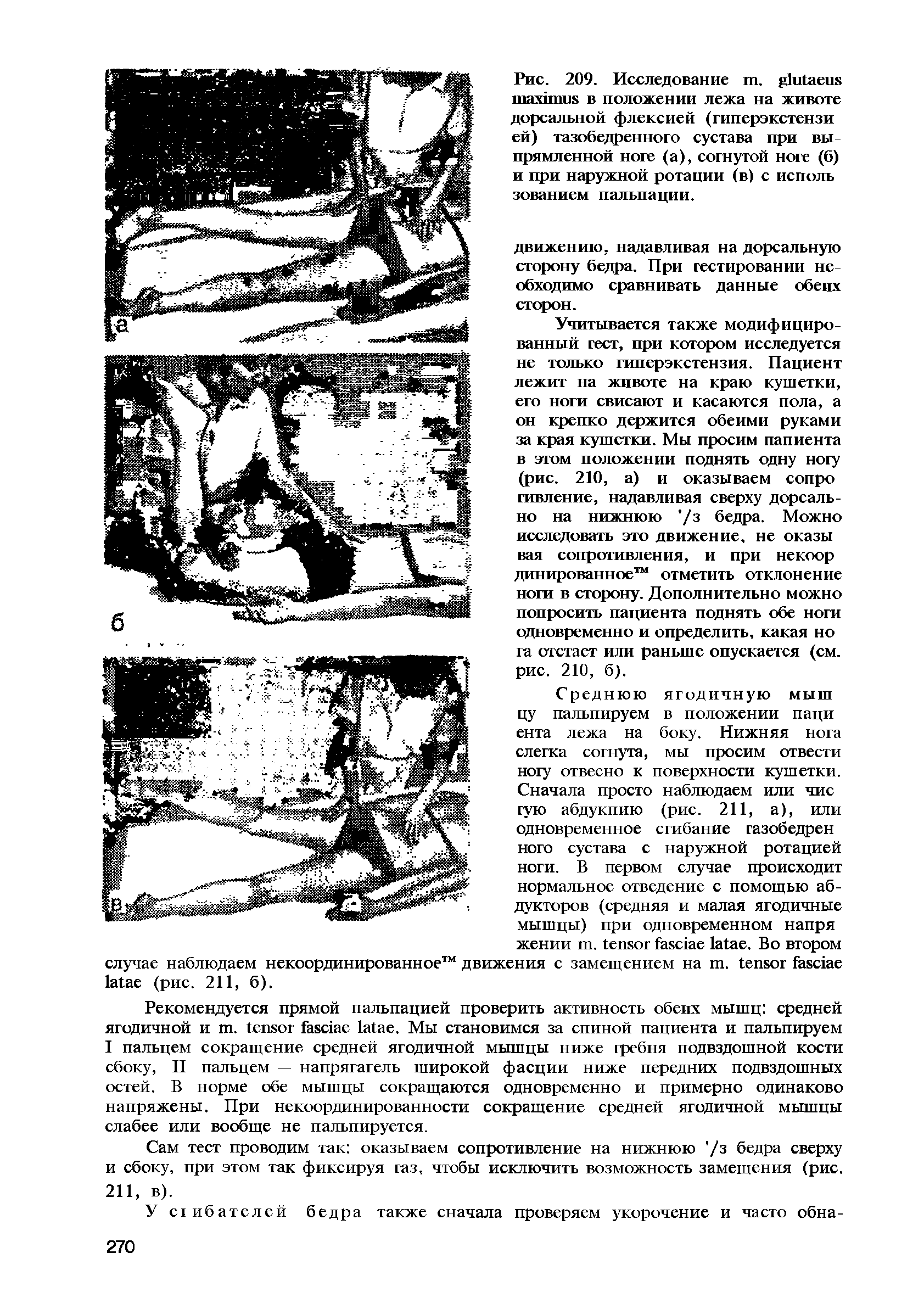 Рис. 209. Исследование . в положении лежа на животе дорсальной флексией (гиперэкстензи ей) тазобедренного сустава при вы прямленной ноге (а), согнутой ноге (б) и при наружной ротации (в) с исполь зованием пальпации.