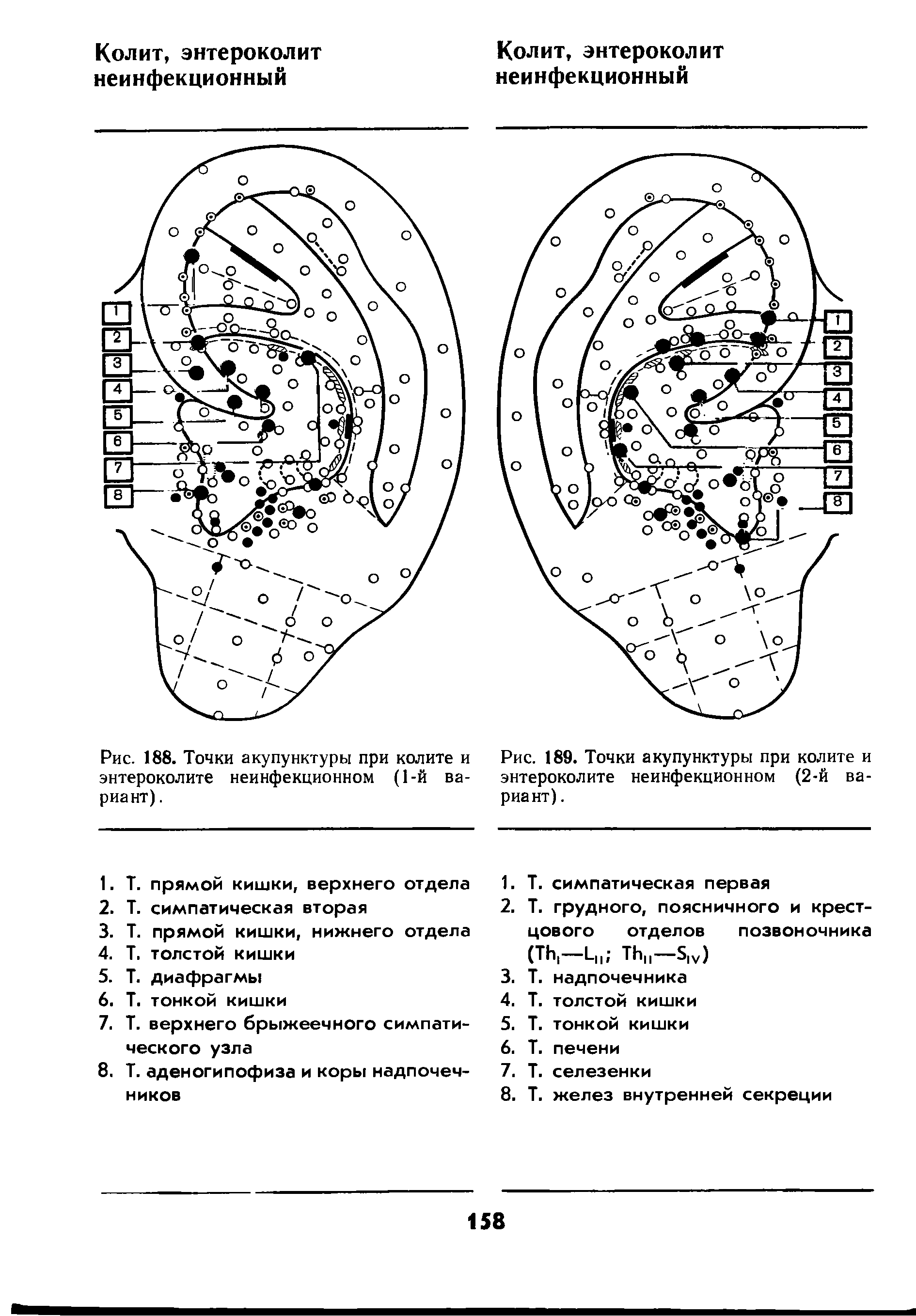 Рис. 188. Точки акупунктуры при колите и энтероколите неинфекционном (1-й вариант). ...