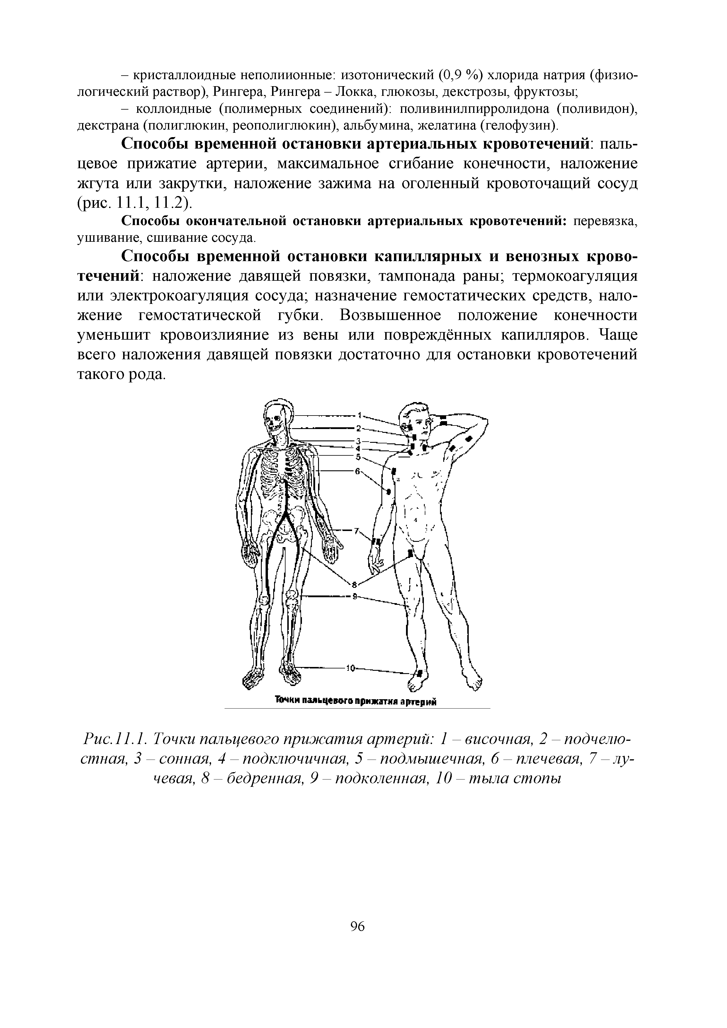 Рис. 11.1. Точки пальцевого прижатия артерий 1 - височная, 2 - подчелюстная, 3 - сонная, 4 - подключичная, 5 - подмышечная, 6 - плечевая, 7 - лучевая, 8 - бедренная, 9 - подколенная, 10 тыла стопы...