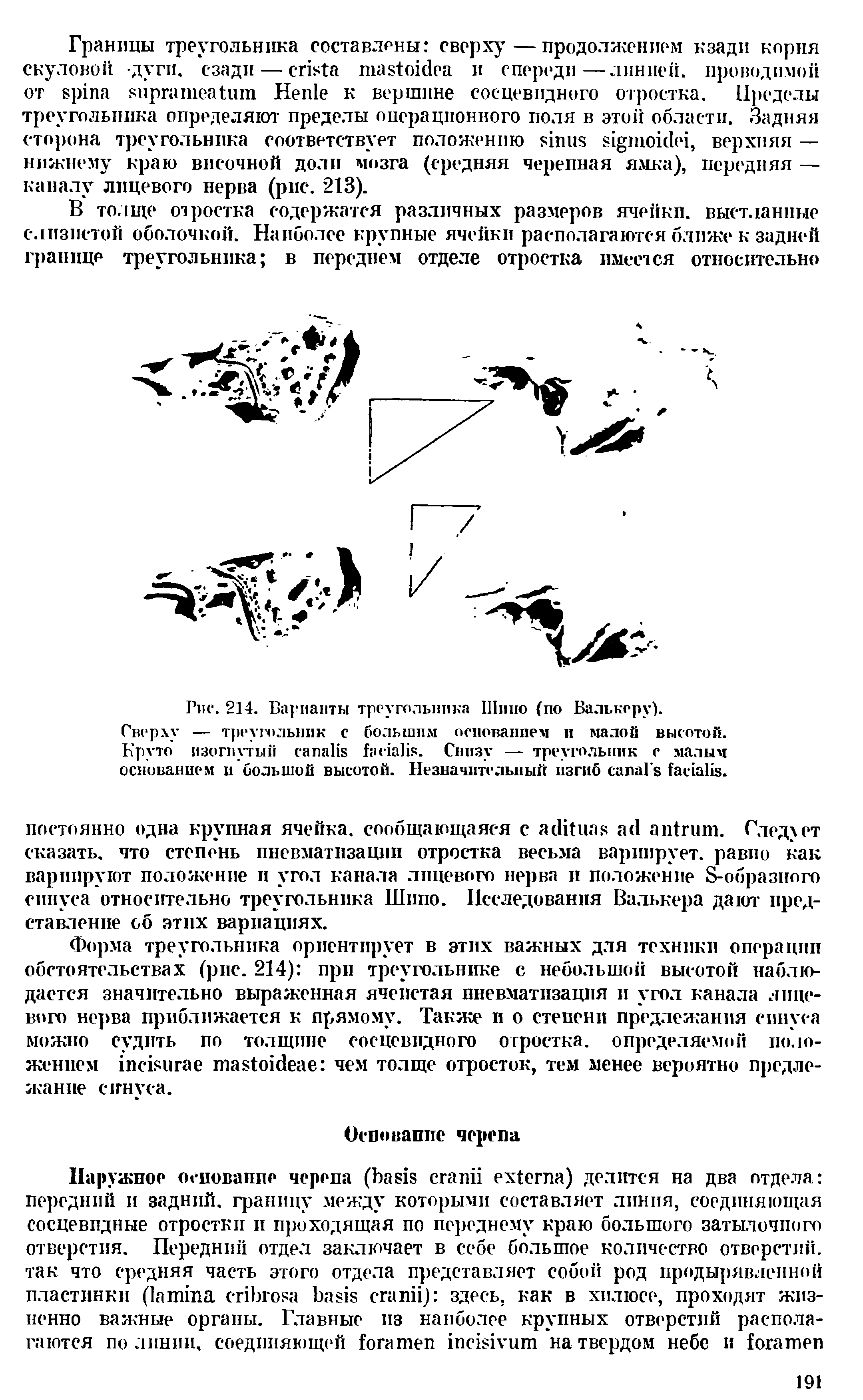 Рис. 214. Варианты треугольника Шппо (по Валькеру). Сверху — треугольник с большим основанием и малой высотой. Круто изогнутый . Снизу — треугольник с малым основанием и большой высотой. Незначительный изгиб .