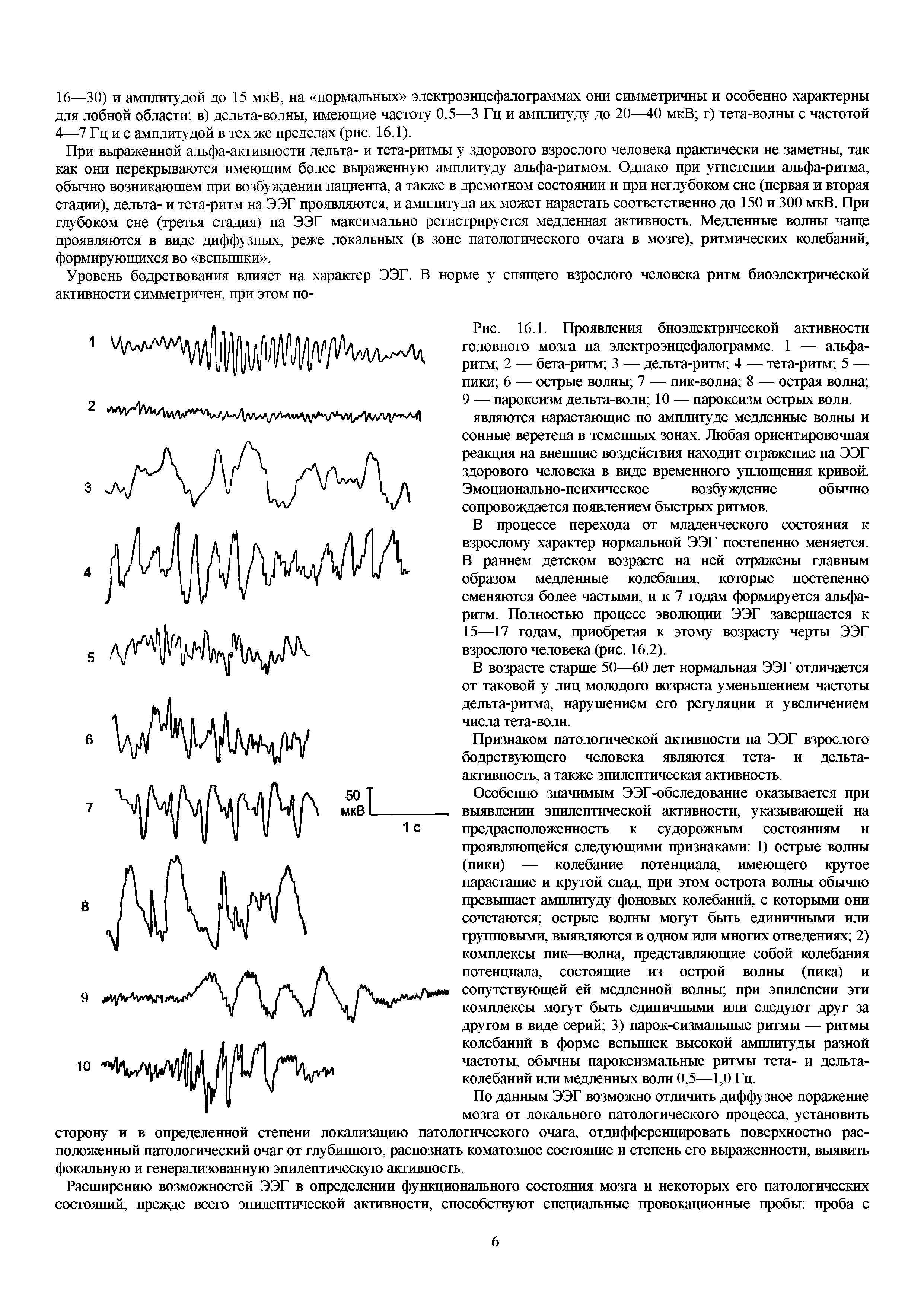 Рис. 16.1. Проявления биоэлектрической активности головного мозга на электроэнцефалограмме. 1 — альфа-ритм 2 — бета-ритм 3 — дельта-ритм 4 — тета-ритм 5 — пики 6 — острые волны 7 — пик-волна 8 — острая волна 9 — пароксизм дельта-волн 10 — пароксизм острых волн.