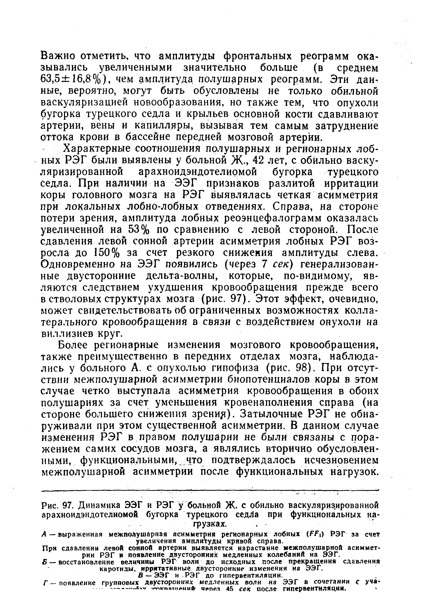 Рис. 97. Динамика ЭЭГ и РЭГ у больной Ж. с обильно васкуляризированной арахноидэндотелиомой бугорка турецкого седла при функциональных нагрузках.