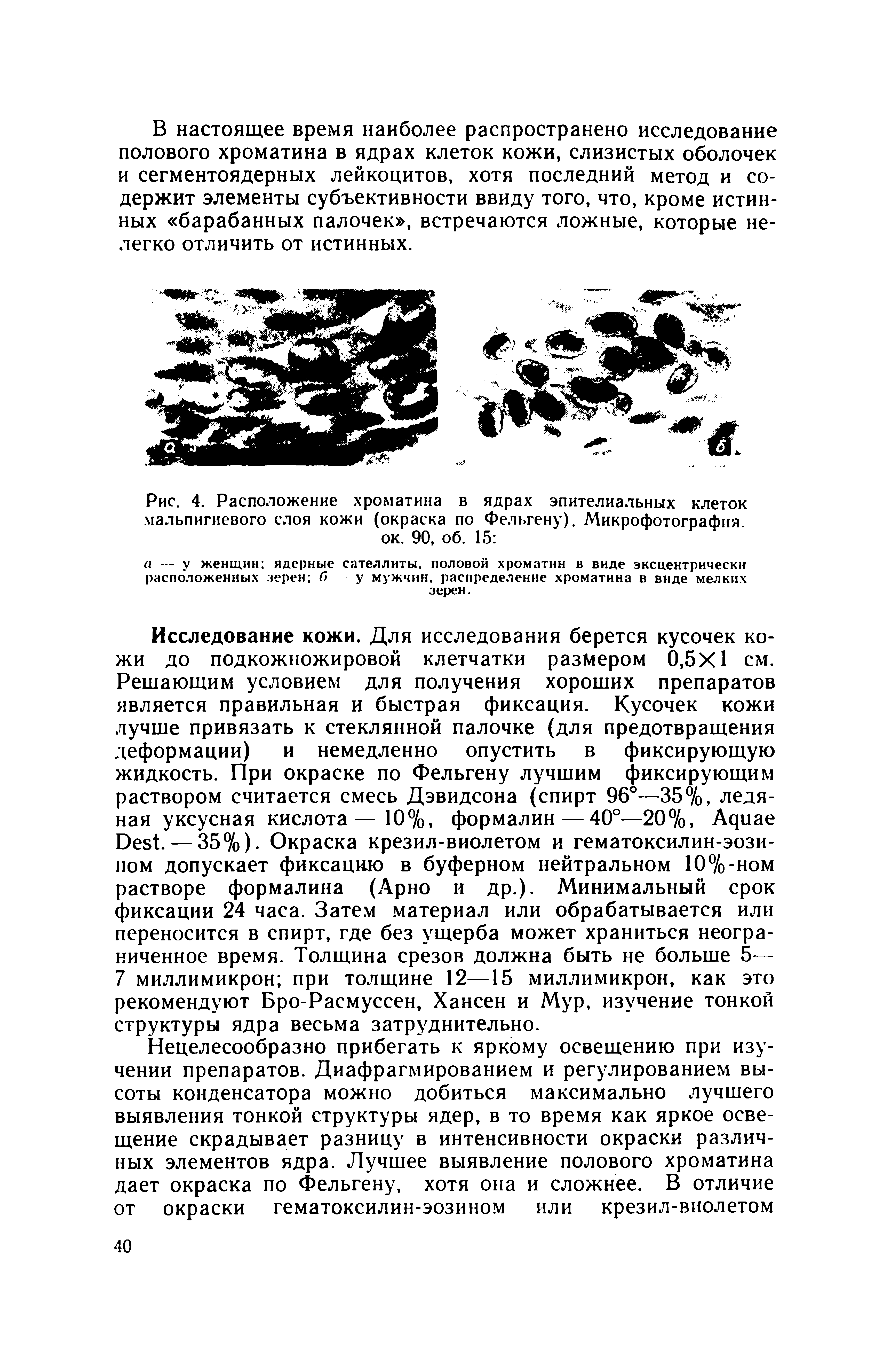 Рис. 4. Расположение хроматина в ядрах эпителиальных клеток мальпигиевого слоя кожи (окраска по Фельгену). Микрофотография.