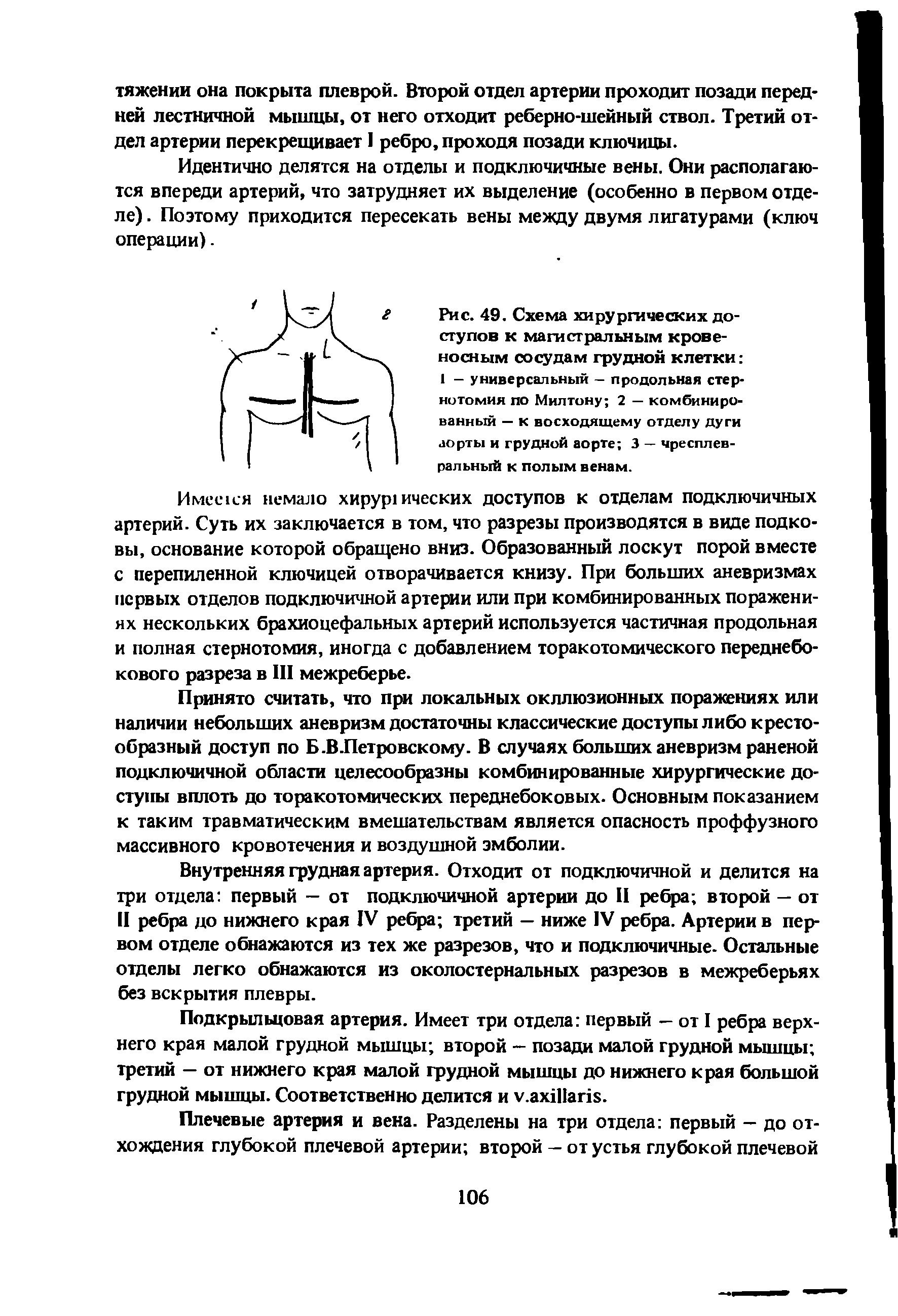 Рис. 49. Схема хирургических доступов к магистральным кровеносным сосудам грудной клетки 1 - универсальный — продольная стернотомия по Милтону 2 — комбинированный — к восходящему отделу дуги аорты и грудной аорте 3 — чресплев-ральный к полым венам.