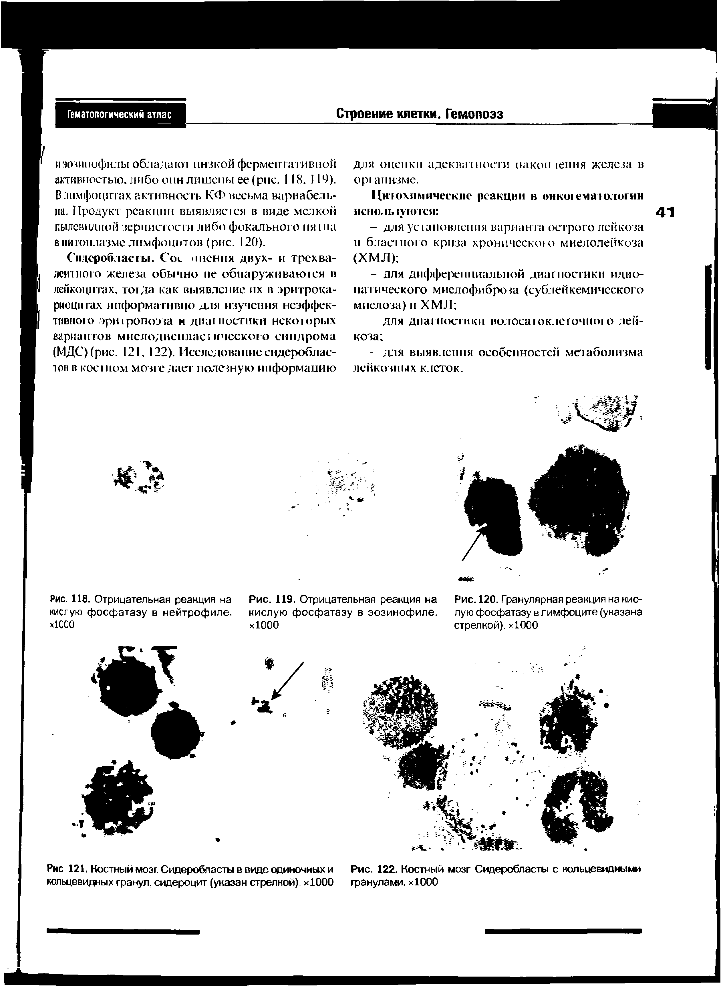 Рис. 122. Костный мозг Сидеробласты с кольцевидными гранулами. хЮОО...