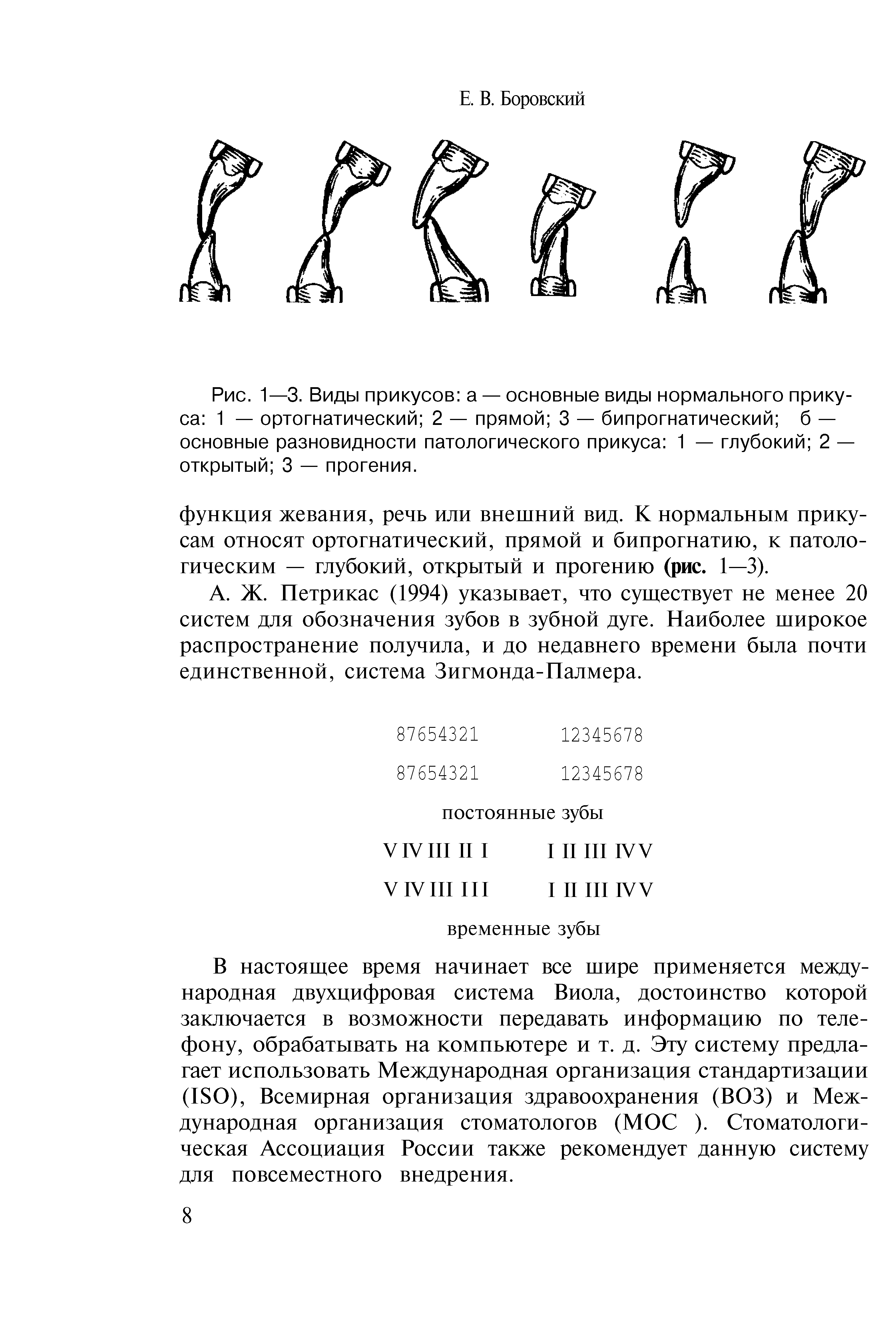 Рис. 1—3. Виды прикусов а — основные виды нормального прикуса 1 — ортогнатический 2 — прямой 3 — бипрогнатический б — основные разновидности патологического прикуса 1 — глубокий 2 — открытый 3 — прогения.