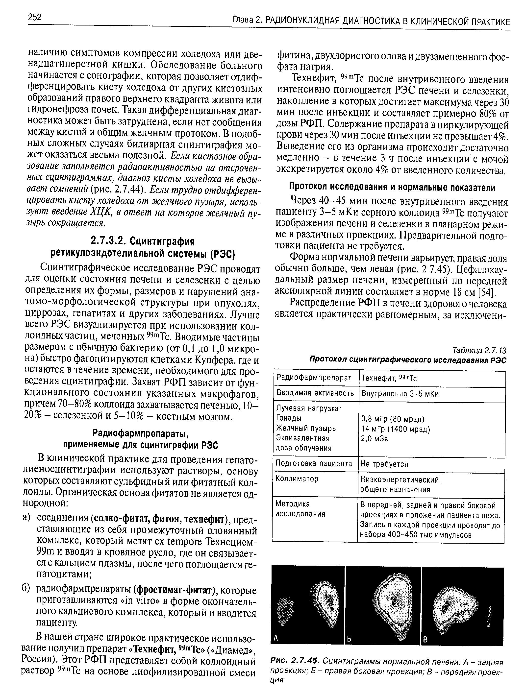 Рис. 2.7.45. Сцинтиграммы нормальной печени А - задняя проекция Б - правая боковая проекция В - передняя проекция...