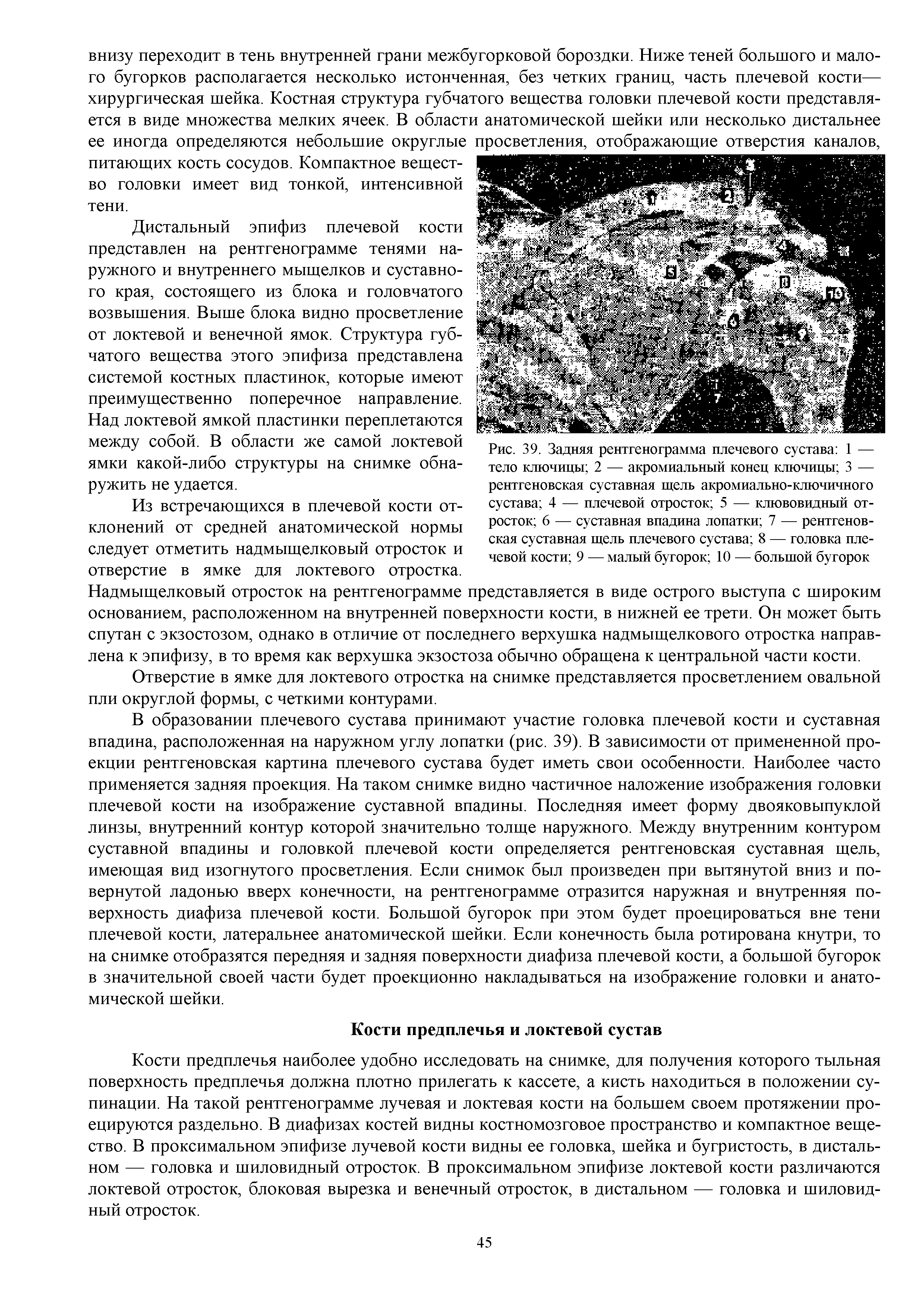 Рис. 39. Задняя рентгенограмма плечевого сустава 1 — тело ключицы 2 — акромиальный конец ключицы 3 — рентгеновская суставная щель акромиально-ключичного сустава 4 — плечевой отросток 5 — клювовидный отросток 6 — суставная впадина лопатки 7 — рентгеновская суставная щель плечевого сустава 8 — головка плечевой кости 9 — малый бугорок 10 — большой бугорок...
