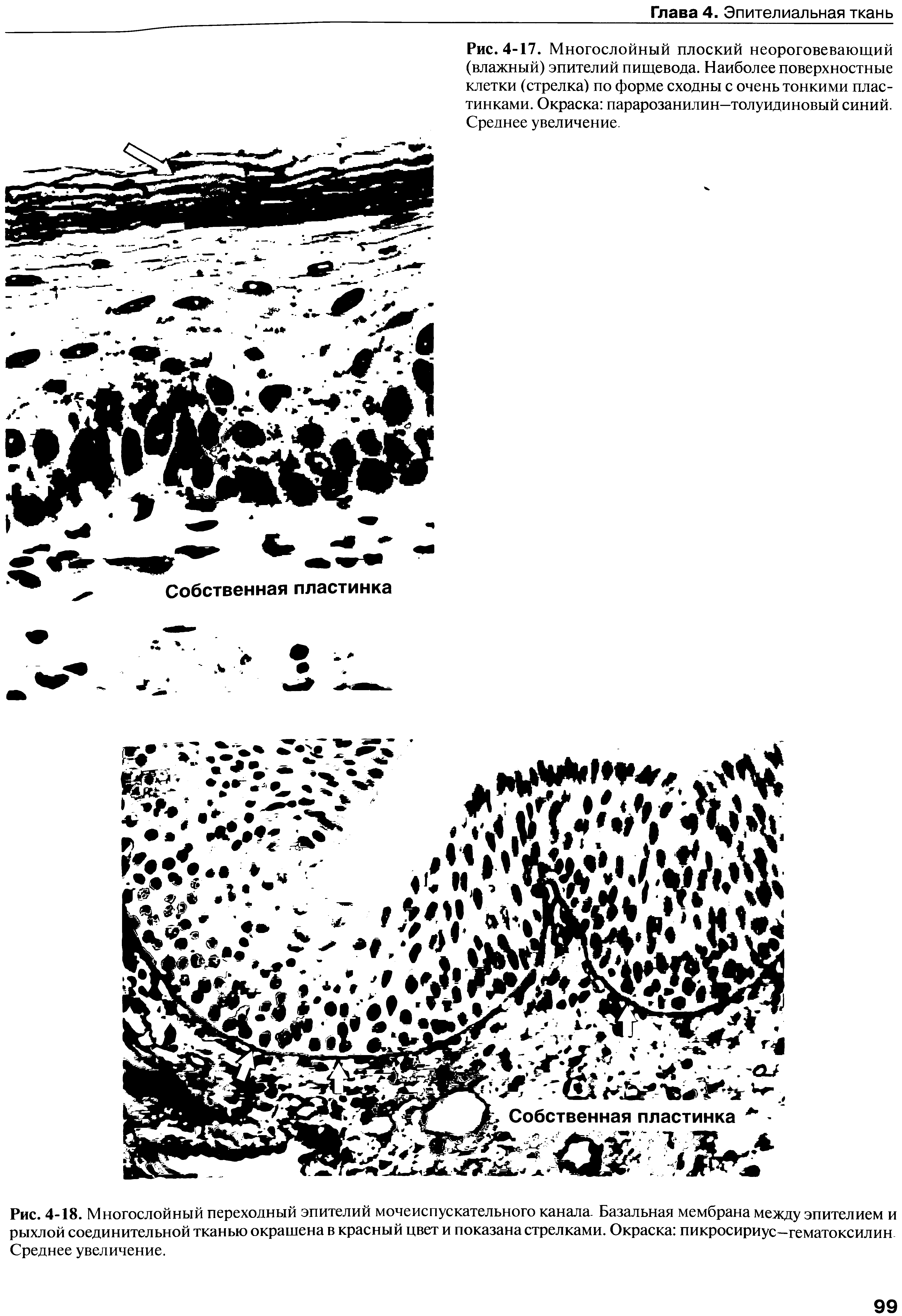Рис. 4-17. Многослойный плоский неороговевающий (влажный) эпителий пищевода. Наиболее поверхностные клетки (стрелка) по форме сходны с очень тонкими пластинками. Окраска парарозанилин—толуидиновый синий. Среднее увеличение.