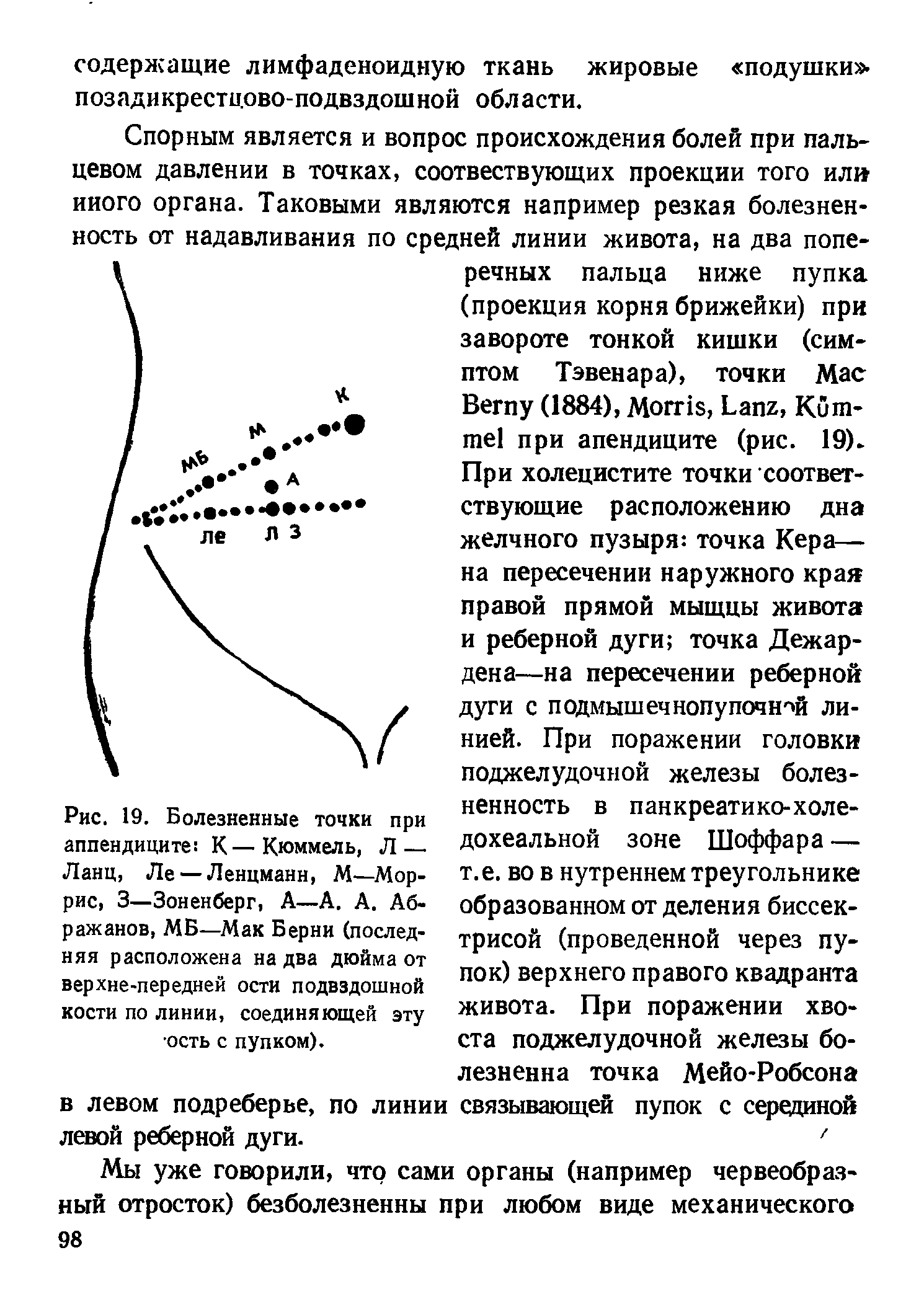 Рис. 19. Болезненные точки при аппендиците К—Кюммель, Л — Ланц, Ле —Ленцманн, М—Моррис, 3—Зоненберг, А—А. А. Аб-ражанов, МБ—Мак Берни (последняя расположена на два дюйма от верхне-передней ости подвздошной кости по линии, соединяющей эту ость с пупком).