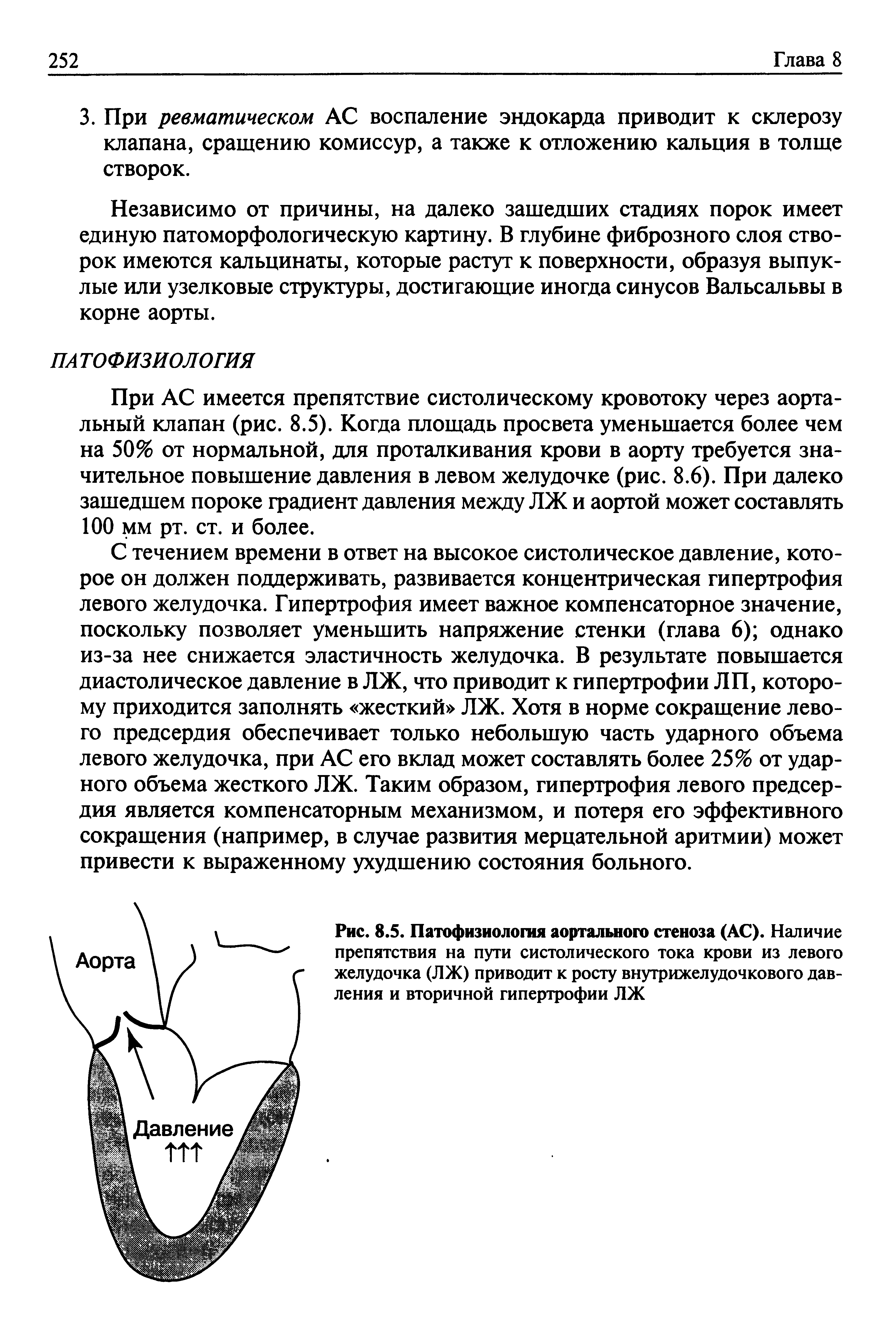 Рис. 8.5. Патофизиология аортального стеноза (АС). Наличие препятствия на пути систолического тока крови из левого желудочка (ЛЖ) приводит к росту внутрижелудочкового давления и вторичной гипертрофии ЛЖ...