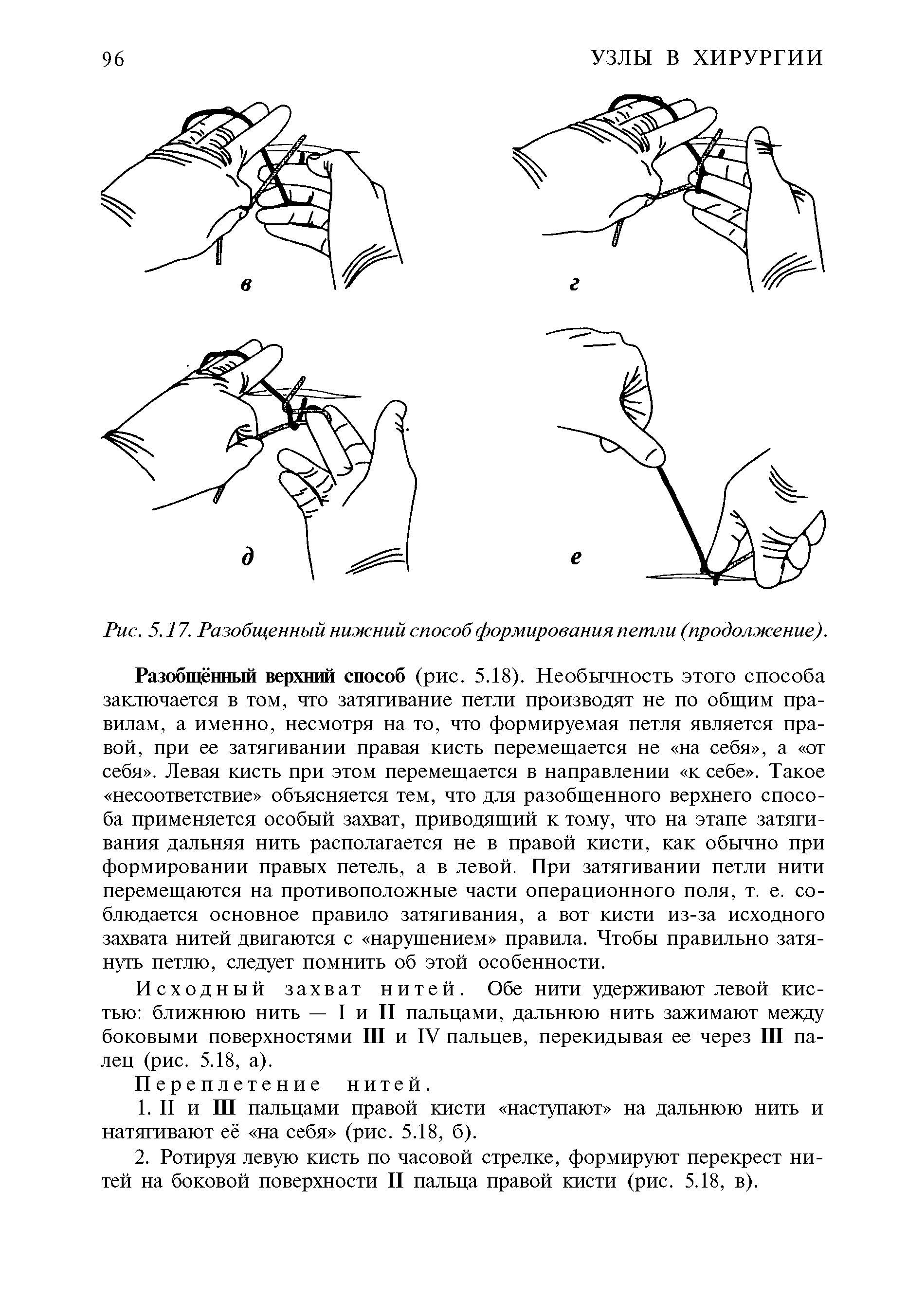 Рис. 5.17. Разобщенный нижний способ формирования петли (продолжение).