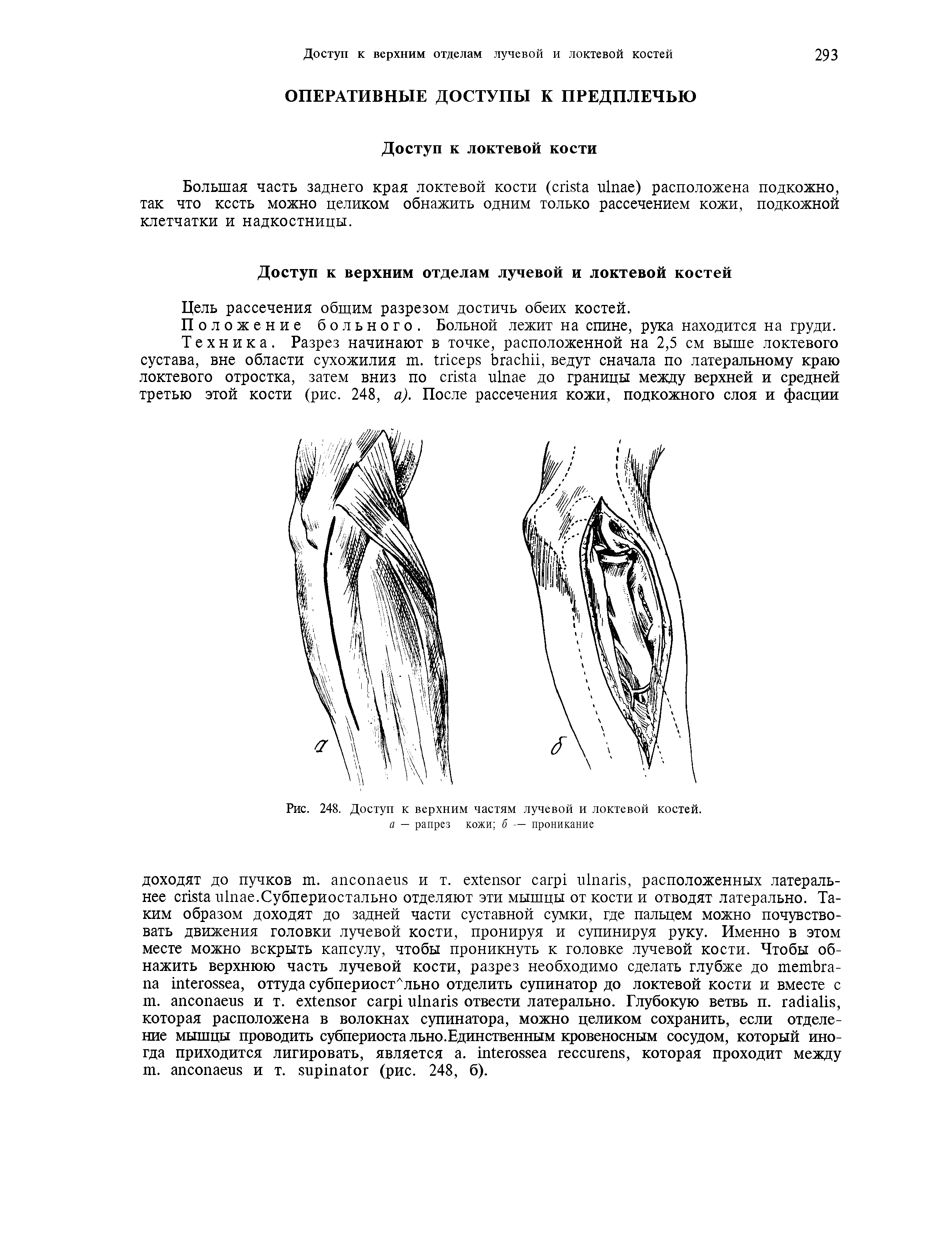 Рис. 248. Доступ к верхним частям лучевой и локтевой костей. а — рапрез кожи б — проникание...