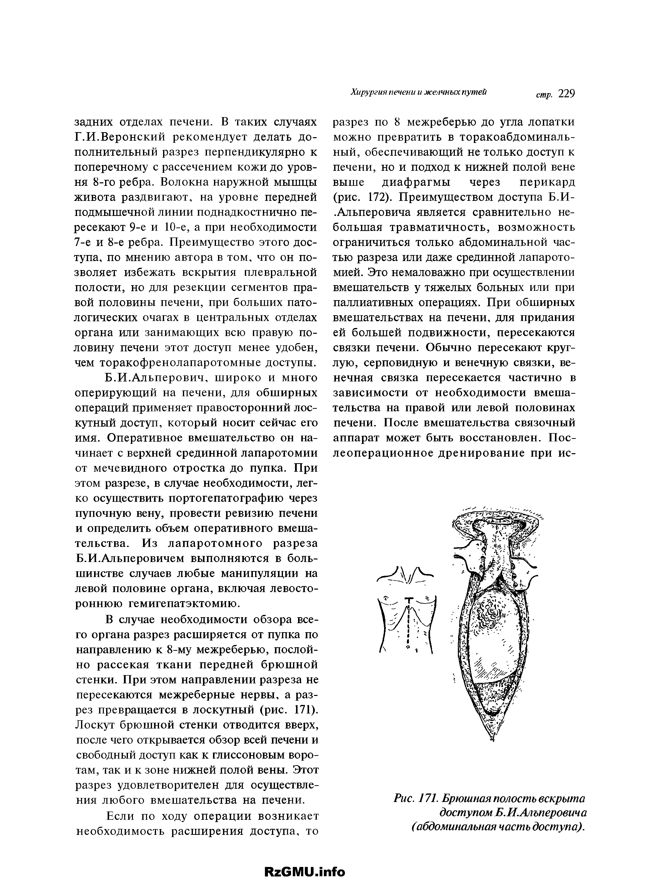 Рис. 171. Брюшная полость вскрыта доступом Б.И.Алъперовича (абдоминальная часть доступа).