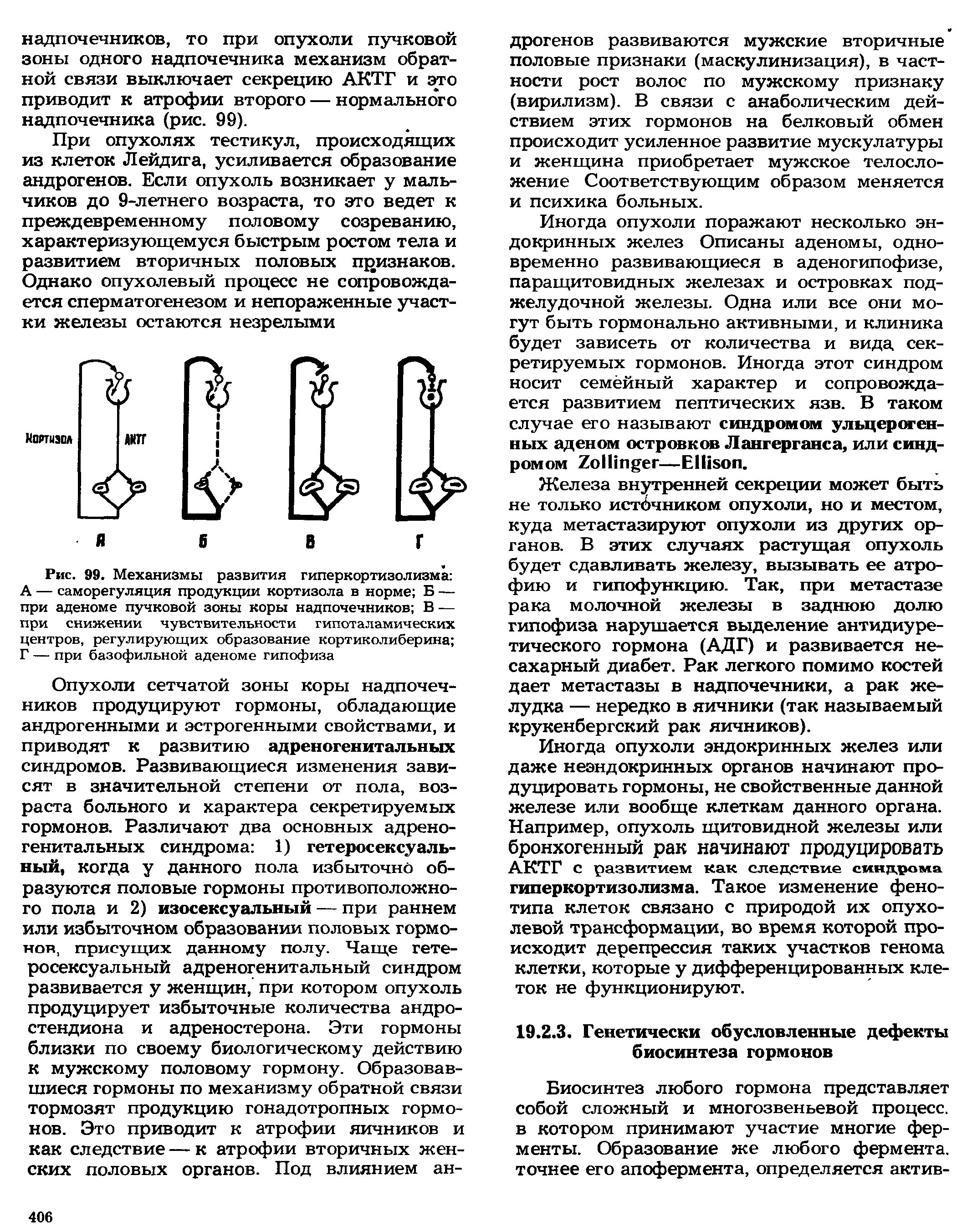 Рис. 99. Механизмы развития гиперкортизолизма А — саморегуляция продукции кортизола в норме Б — при аденоме пучковой зоны коры надпочечников В — при снижении чувствительности гипоталамических центров, регулирующих образование кортиколиберина Г — при базофильной аденоме гипофиза...