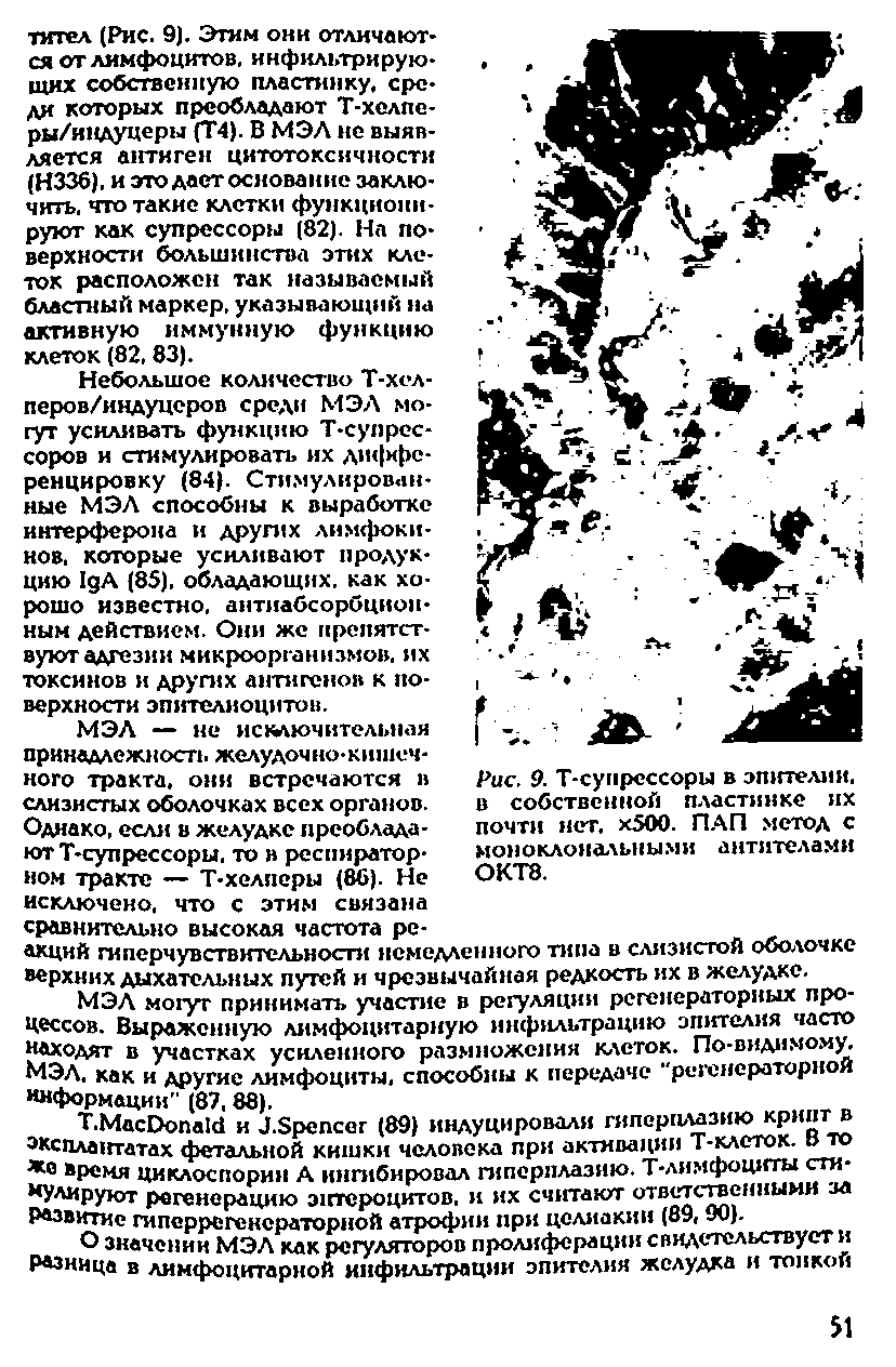 Рис. 9. Т-супрсссоры в эпителии, в собственной пластинке их почти нет. х500. ПАП метод с моноклональными антителами ОКТ8.