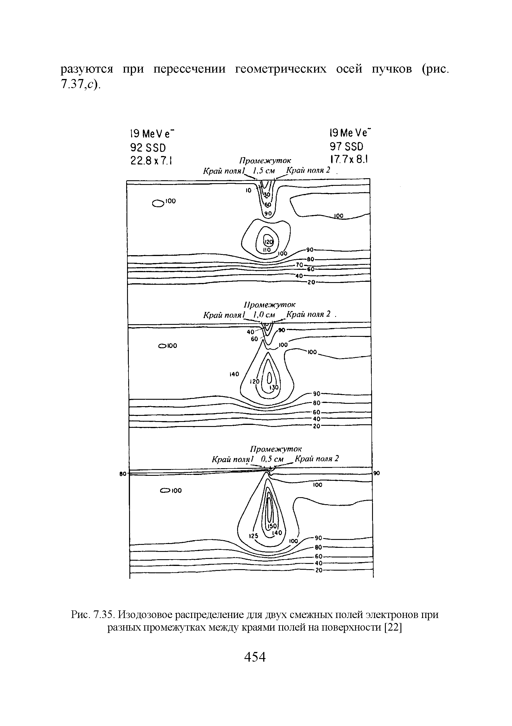 Рис. 7.35. Изодозовое распределение для двух смежных полей электронов при разных промежутках между краями полей на поверхности [22]...