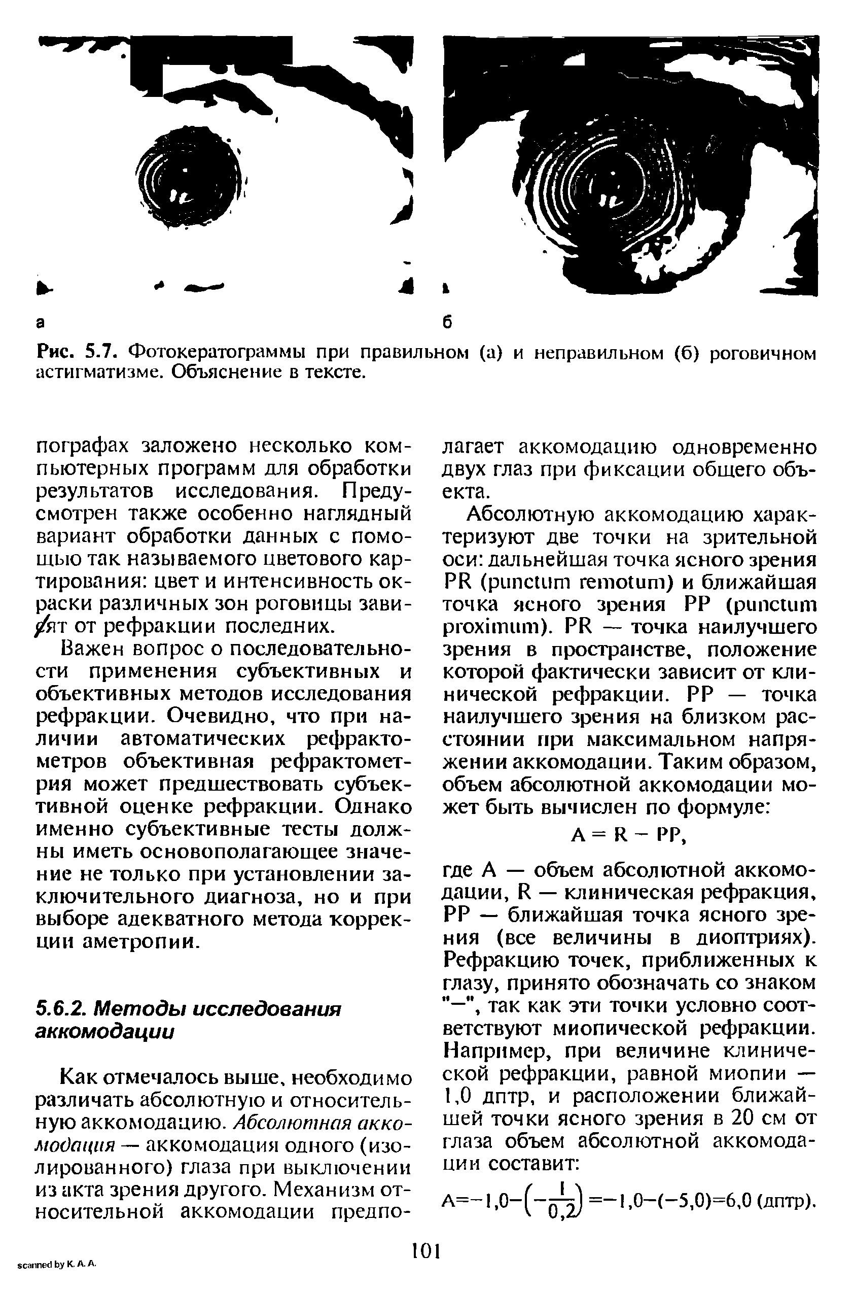 Рис. 5.7. Фотокератограммы при правильном (а) и неправильном (б) роговичном астигматизме. Объяснение в тексте.