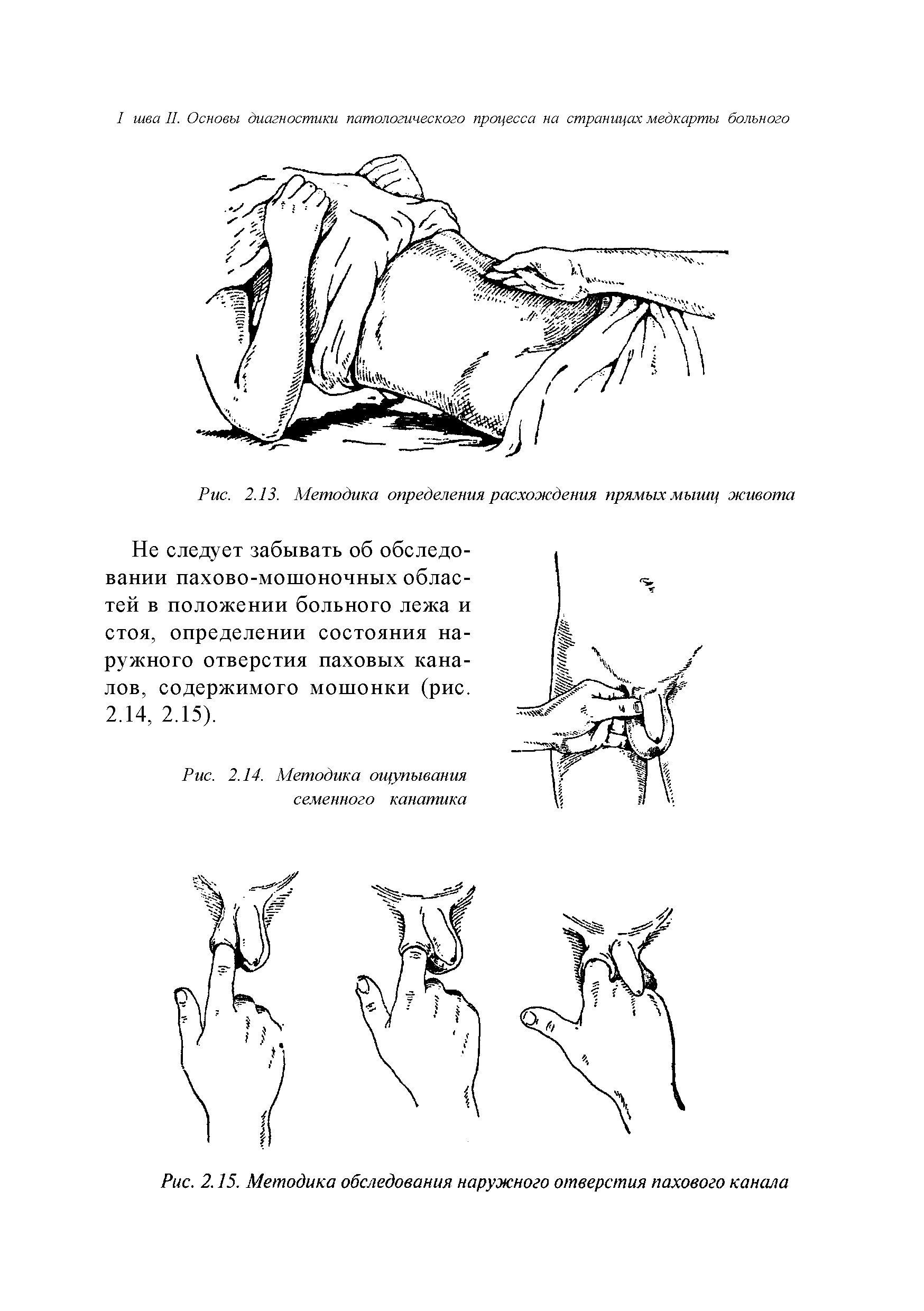 Рис. 2.15. Методика обследования наружного отверстия пахового канала...